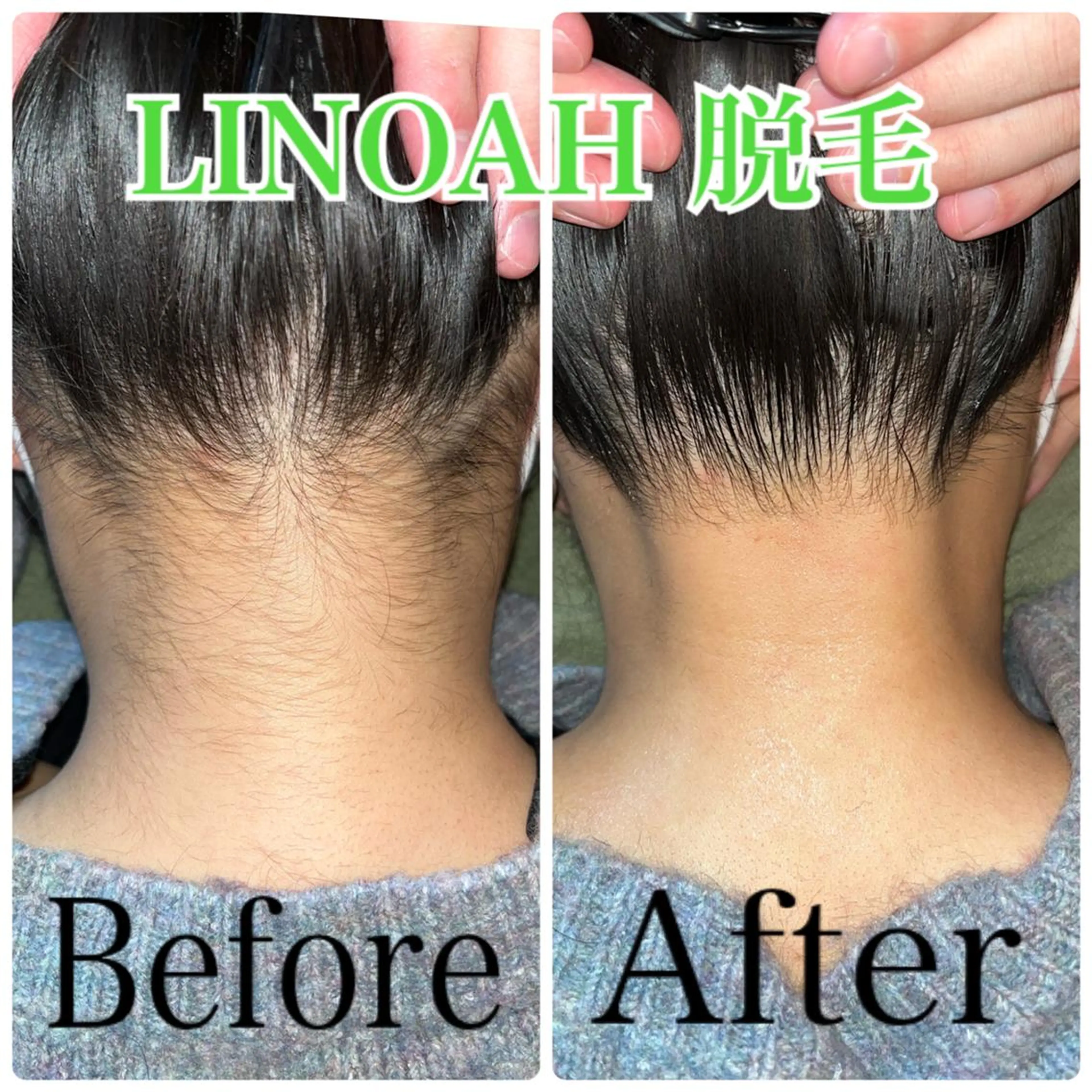 脱毛 ビューティーサロン リノアのエステ・リラクイメージ