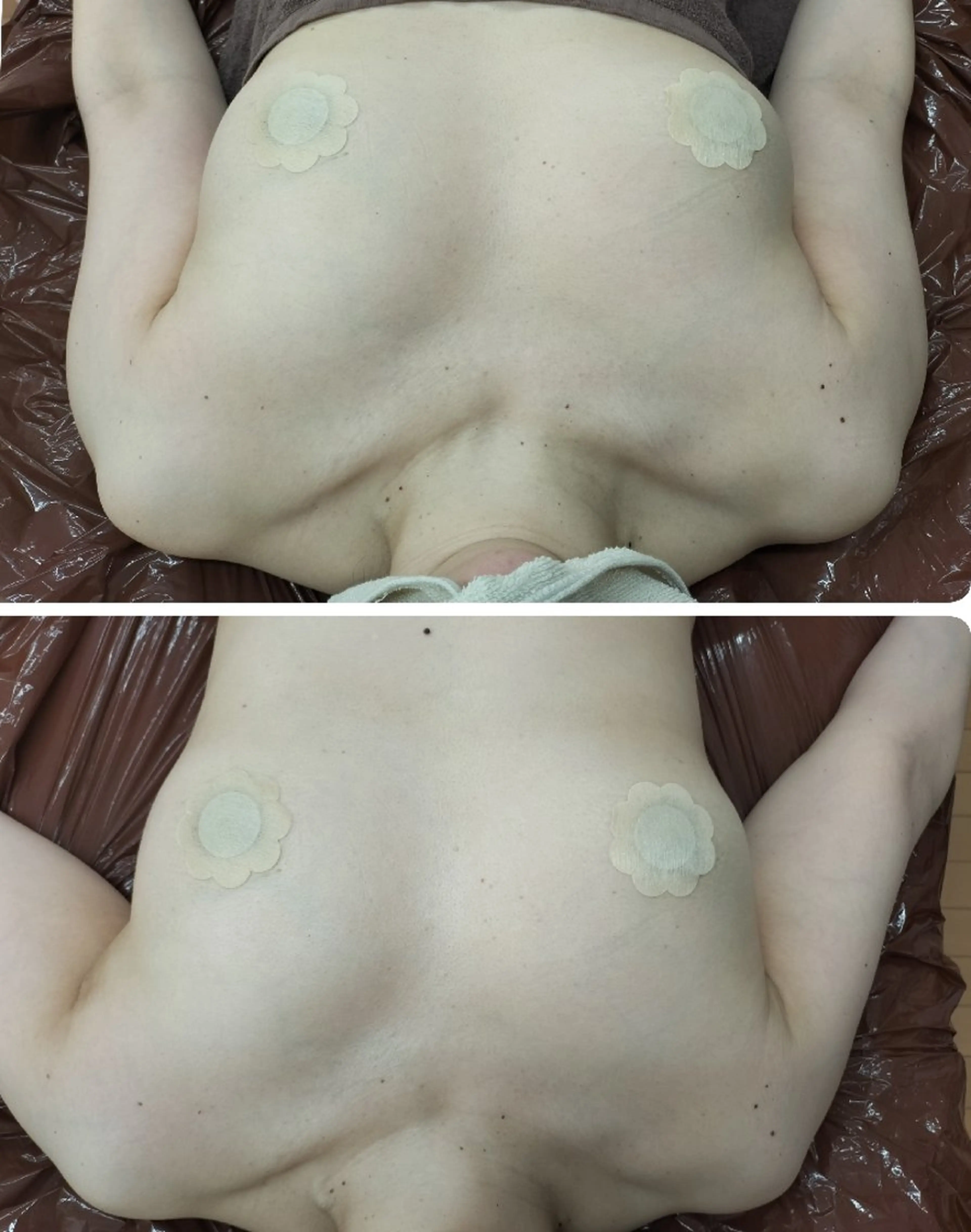 左右差改善！プリンセスバスト60分の写真