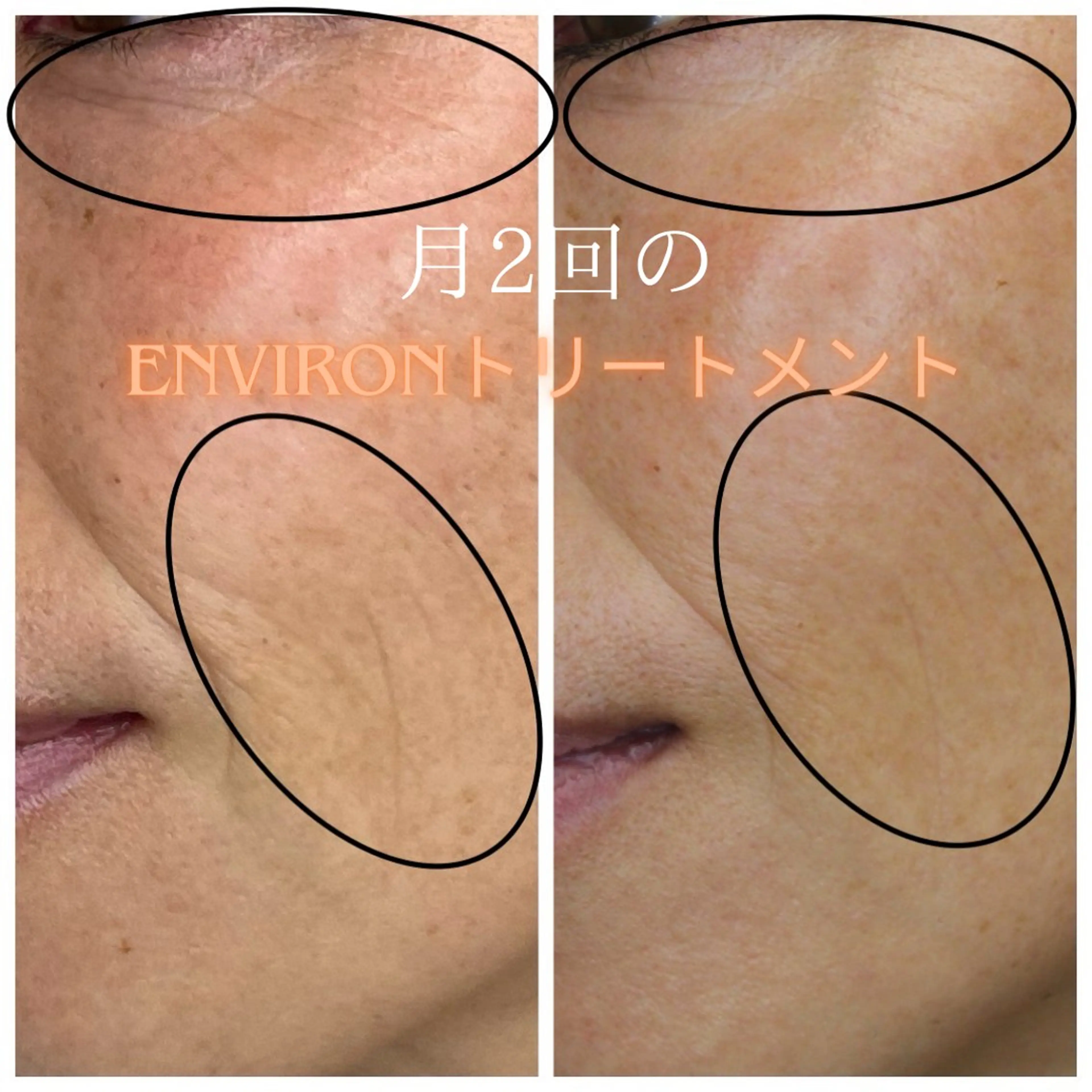 その他 moe beauty salon所属・moe sayuriのエステ・リラクイメージ