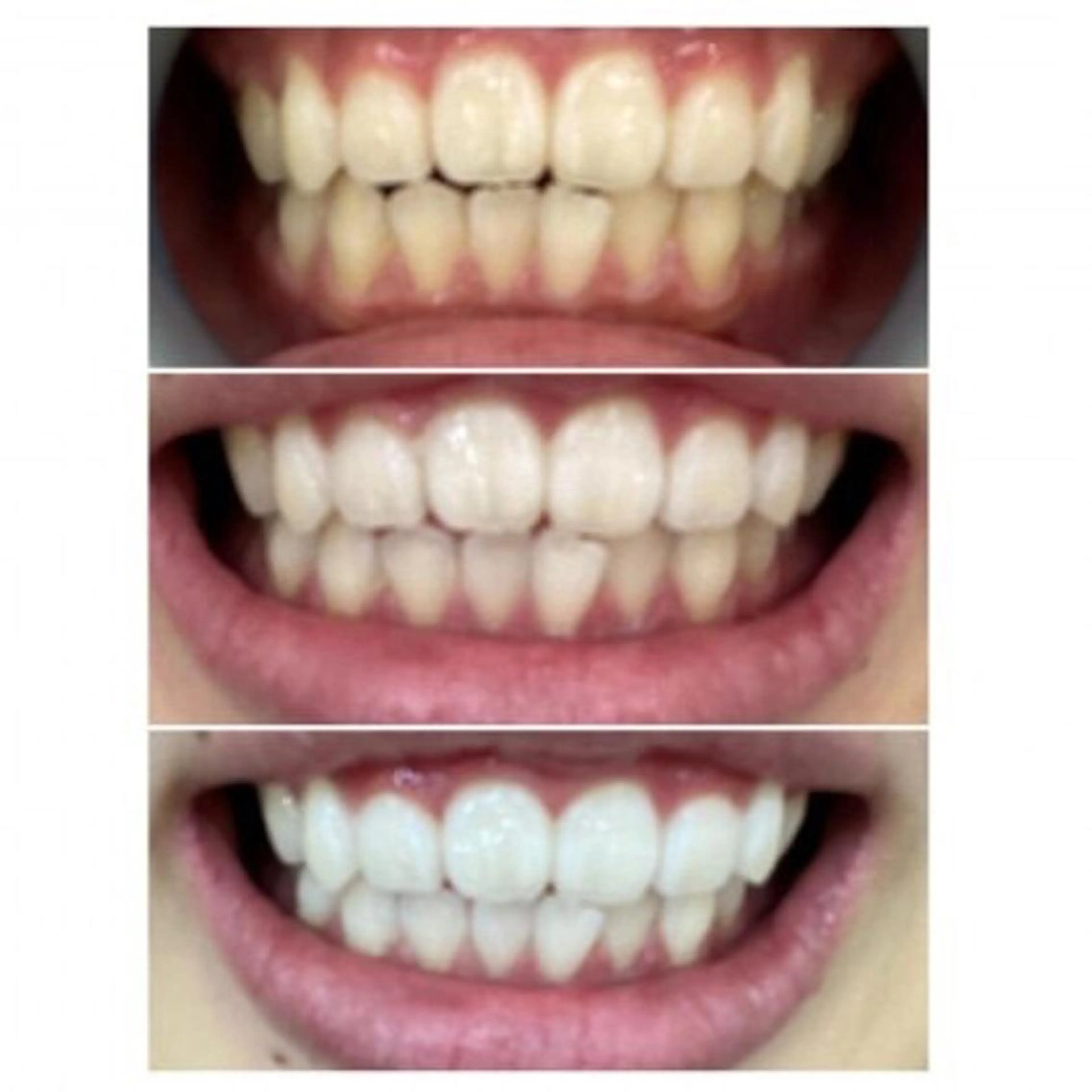 M渋谷店所属・Ｍ渋谷 ホワイトニングのエステ・リラクイメージ