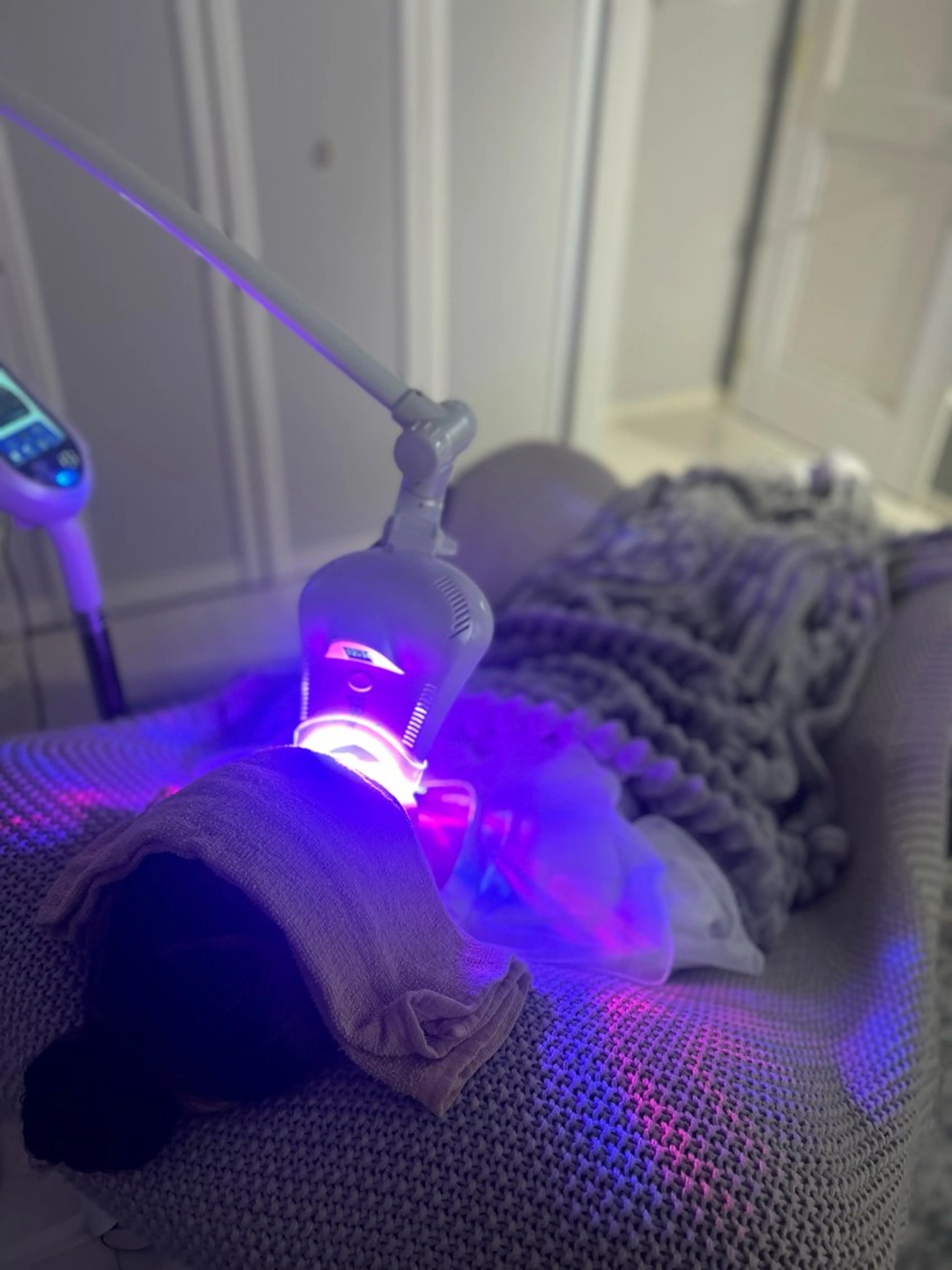 io teeth careのその他イメージ