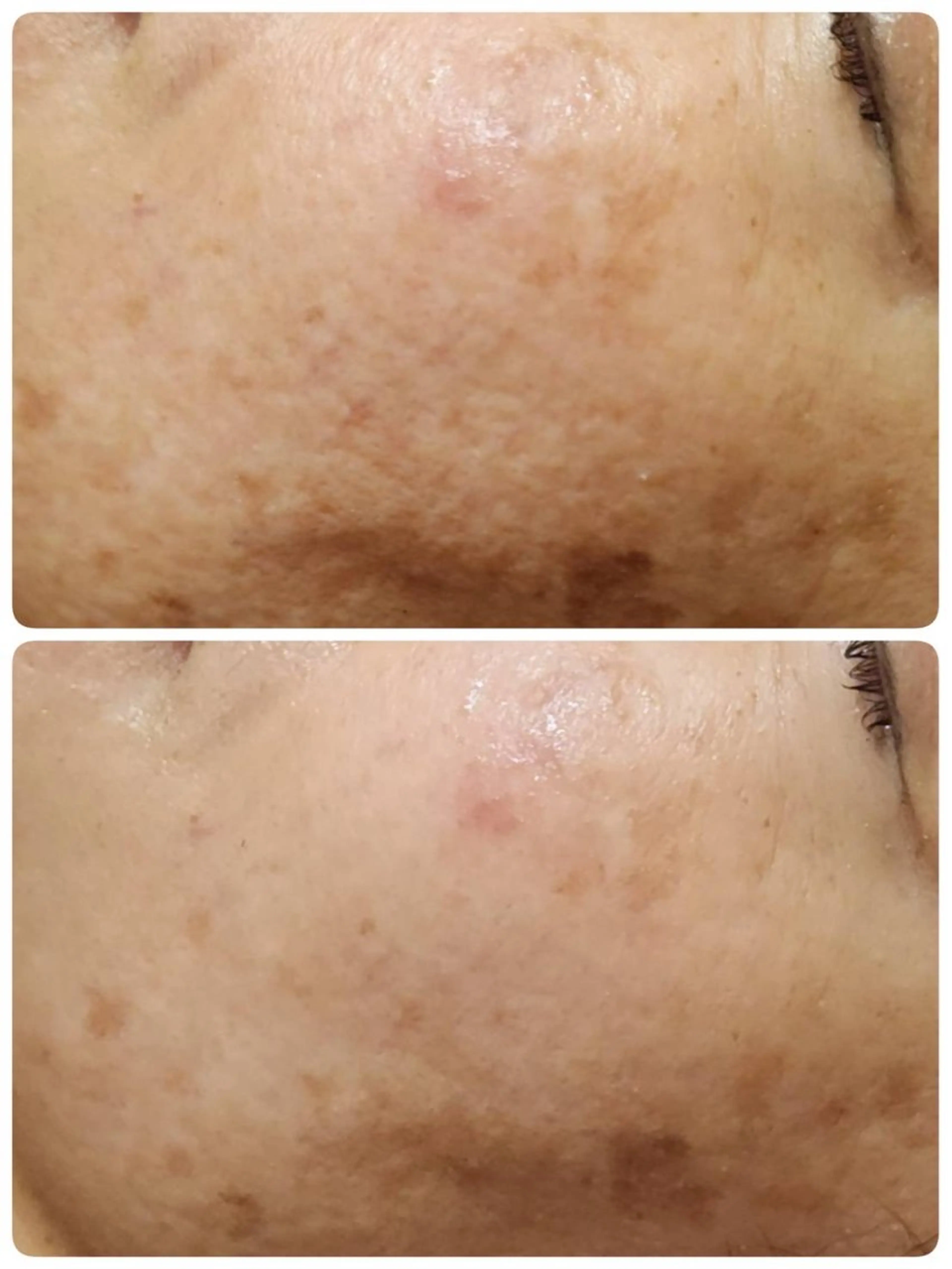 その他 Astorie 相模大野エステのその他イメージ