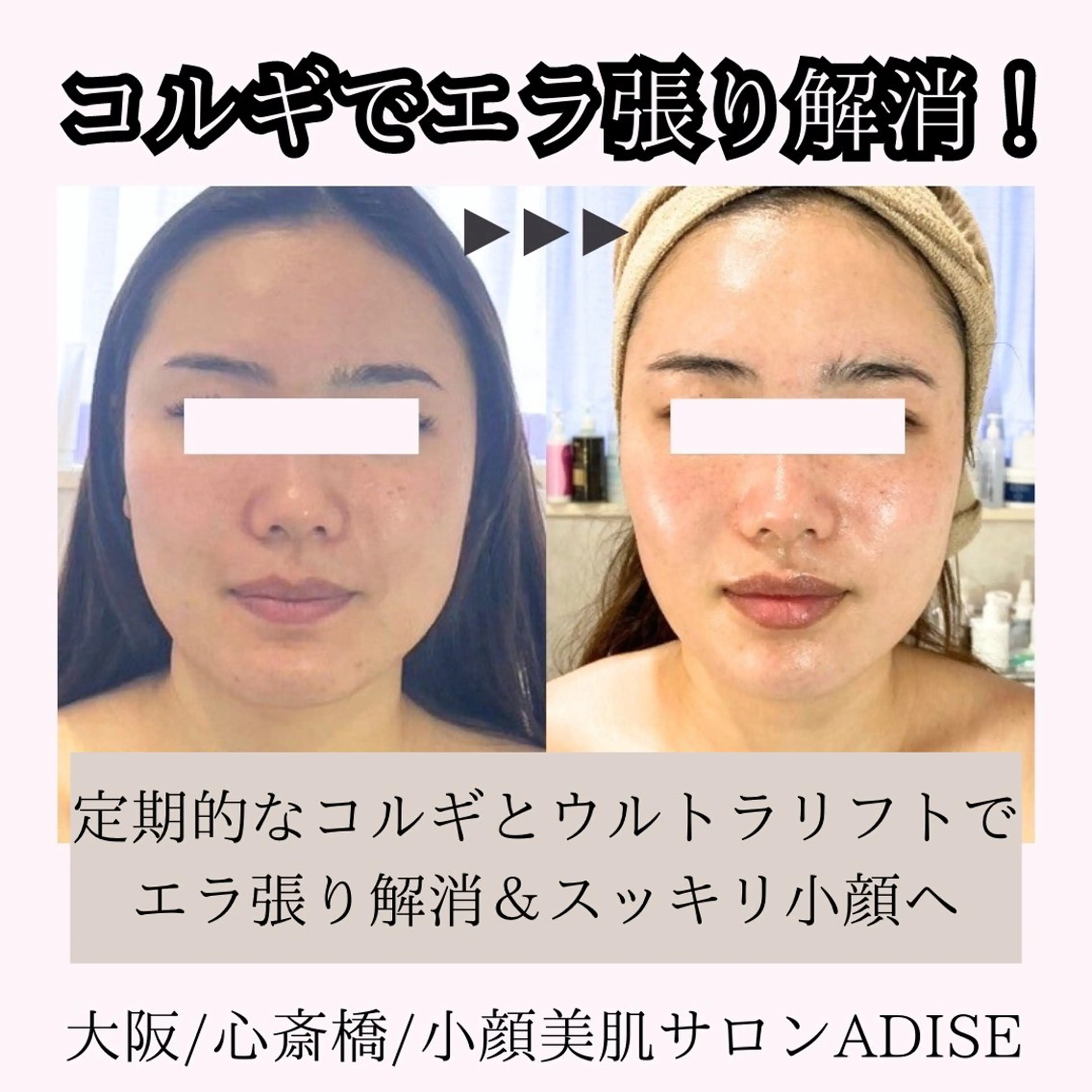 第一印象専門サロン ADISEのエステ・リラクイメージ