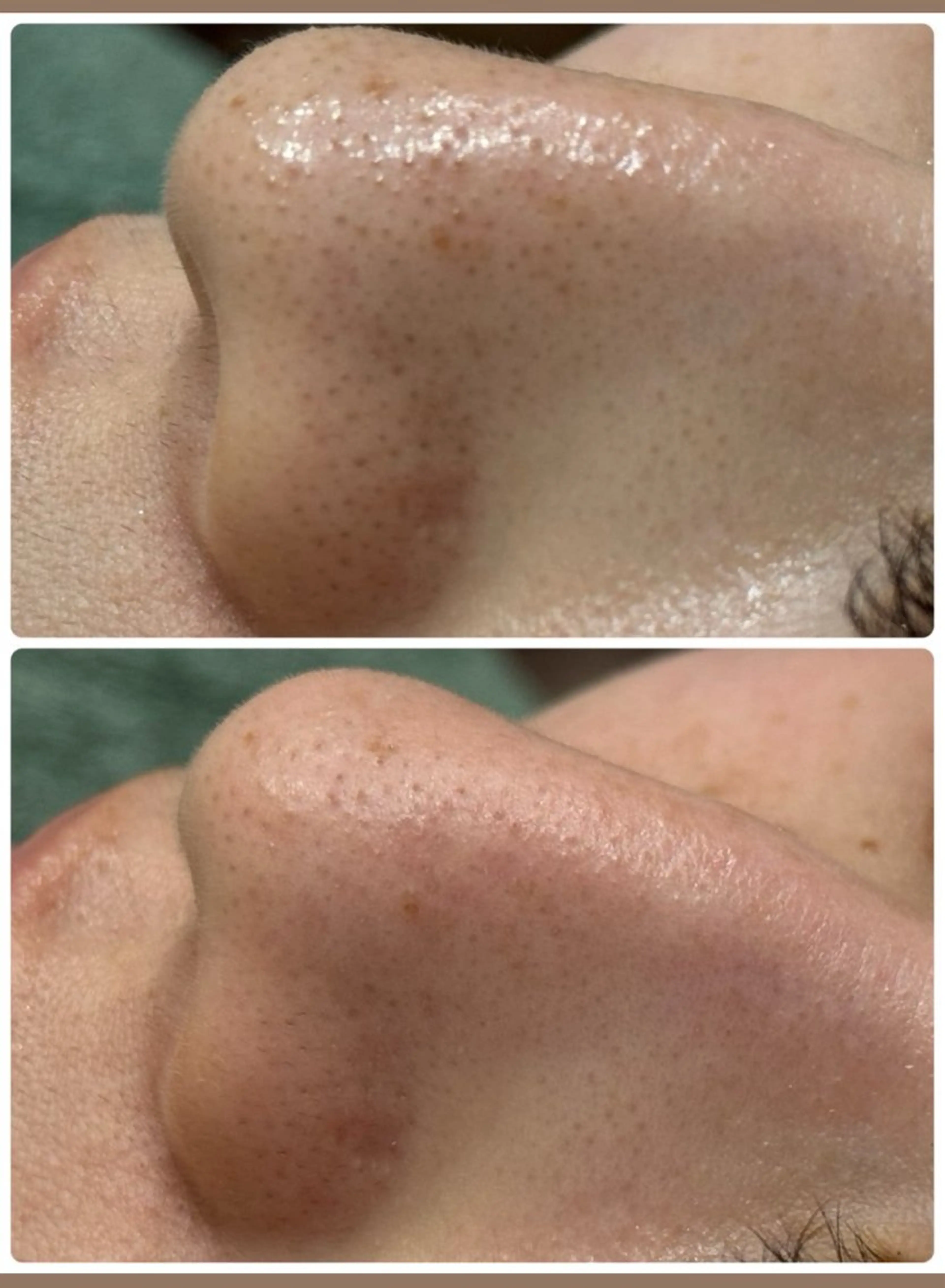 美肌脱毛サロン muroのエステ・リラクイメージ