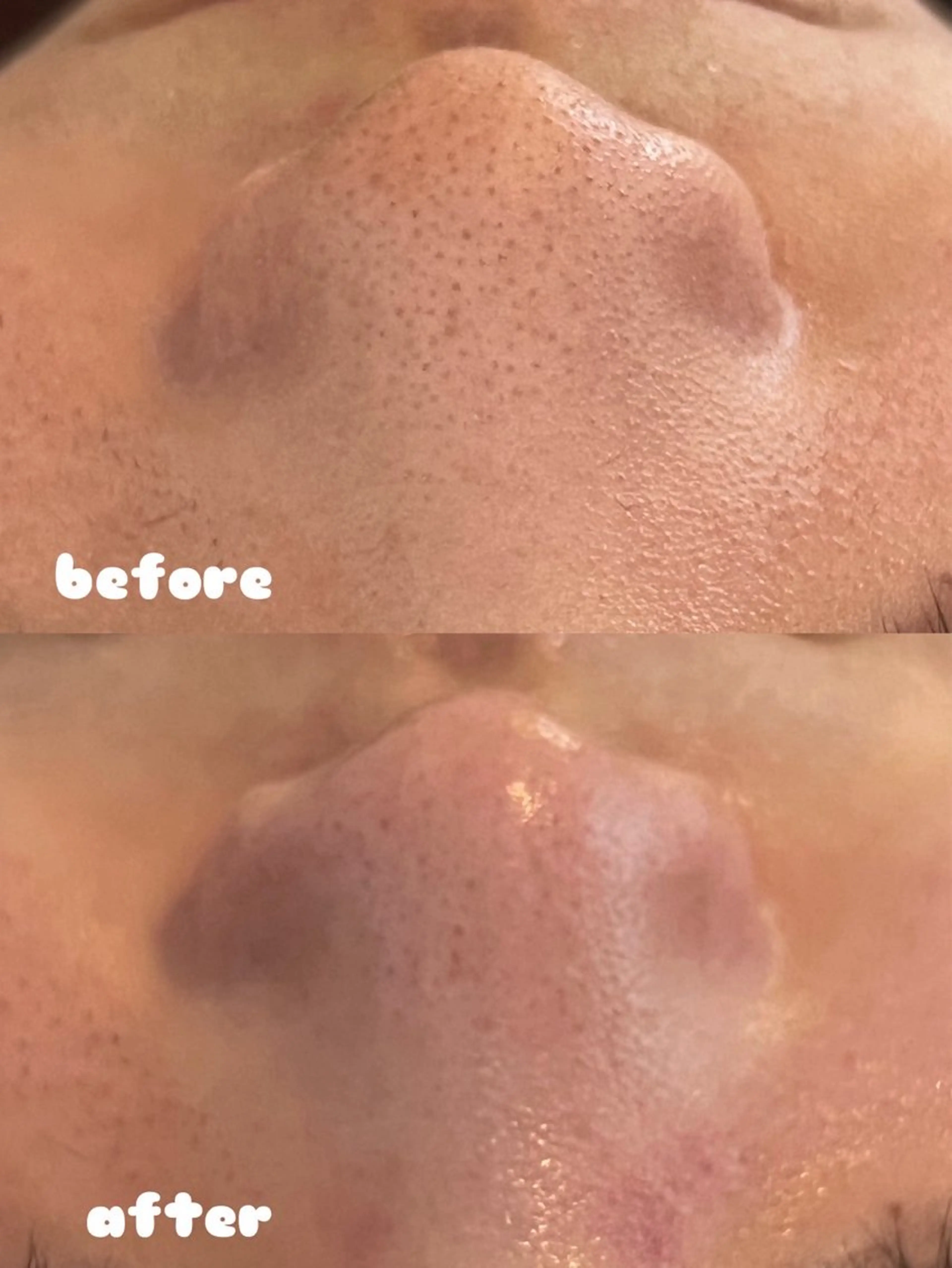 エステ リンパ×ハーブ蒸し TIARA.烏丸三条のエステ・リラクイメージ