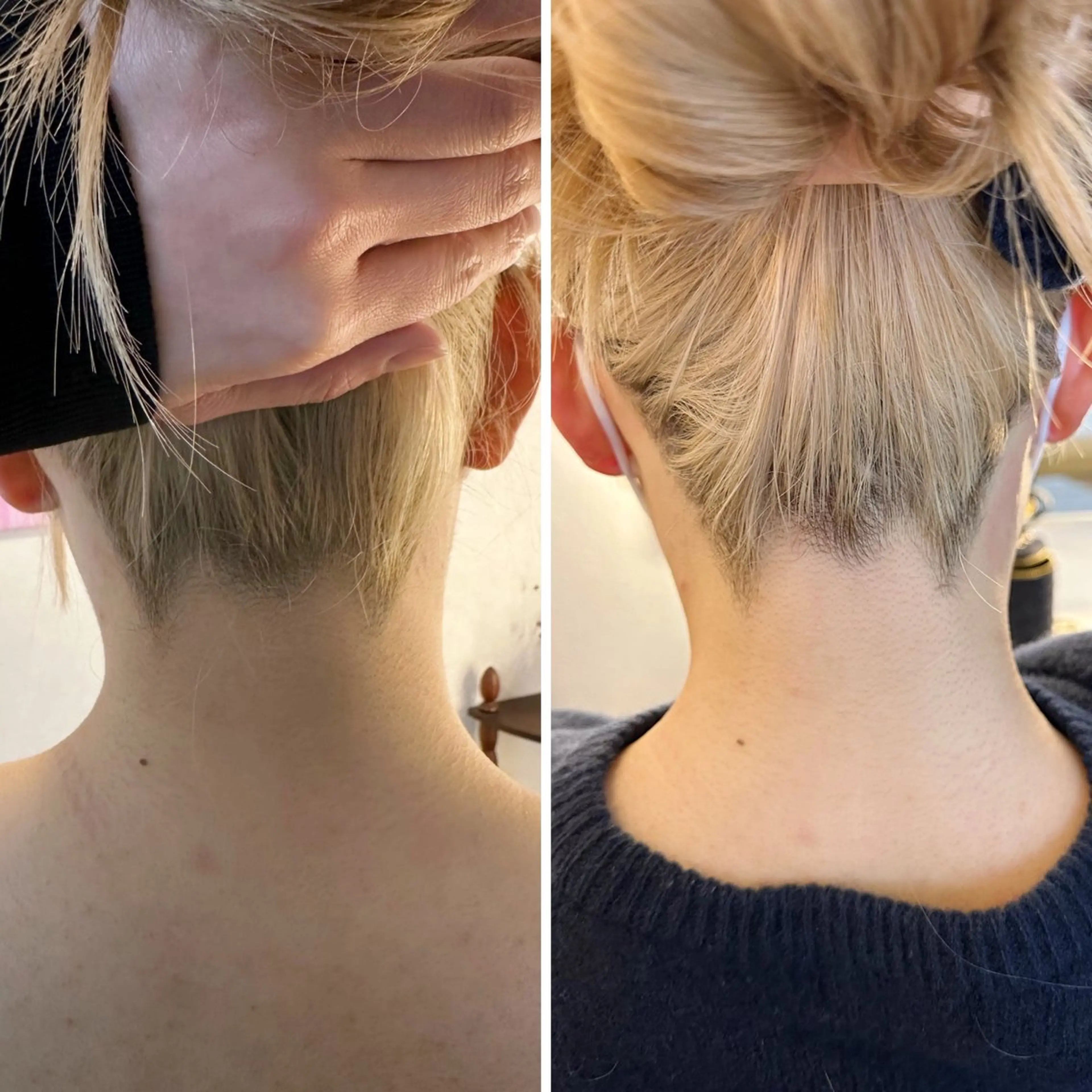 脱毛 うなじ脱毛/美肌脱毛 LABELのエステ・リラクイメージ