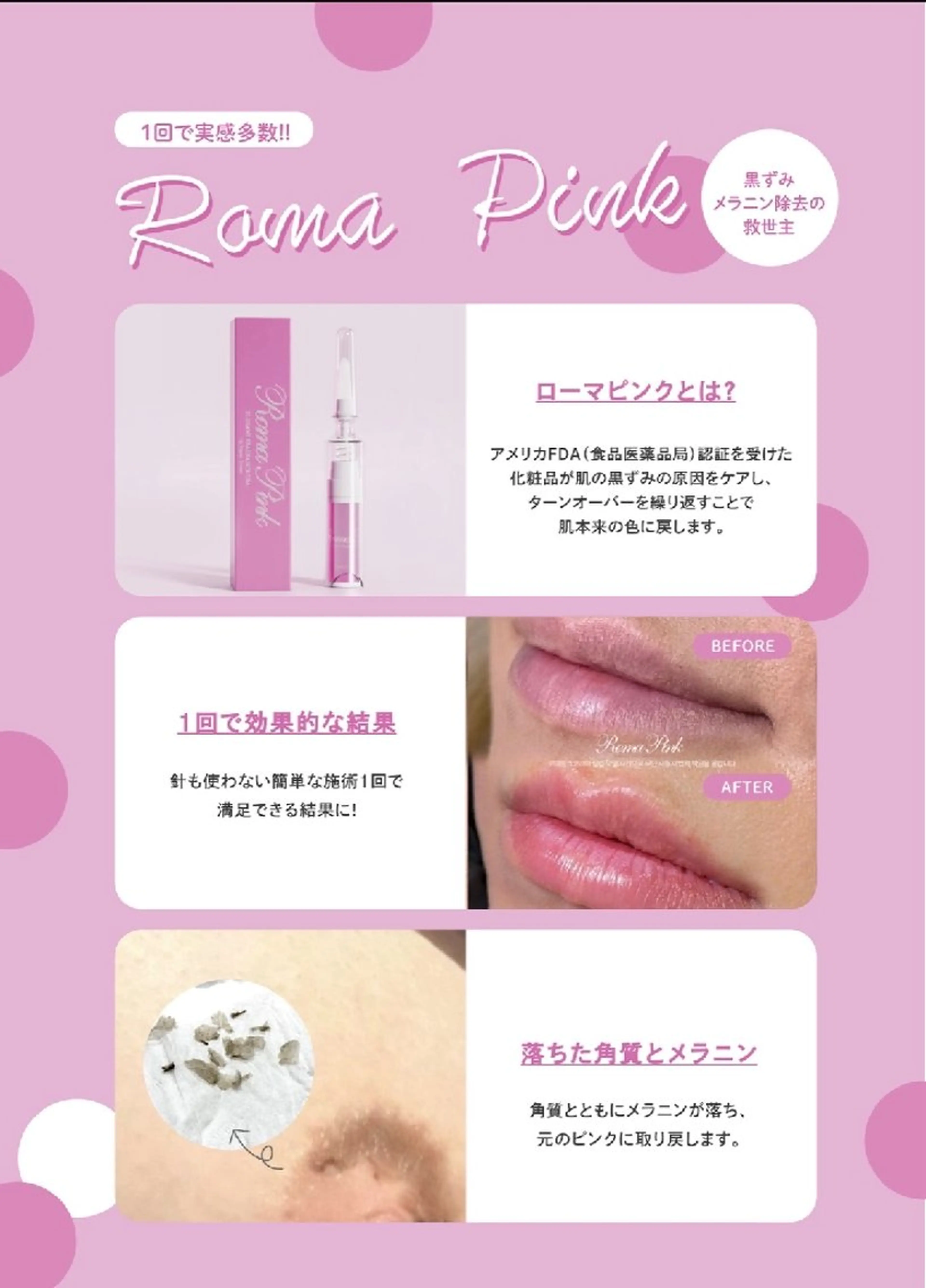 医療提携Ruby所属・医療提携Ruby小顔 ハーブピーリングのその他イメージ