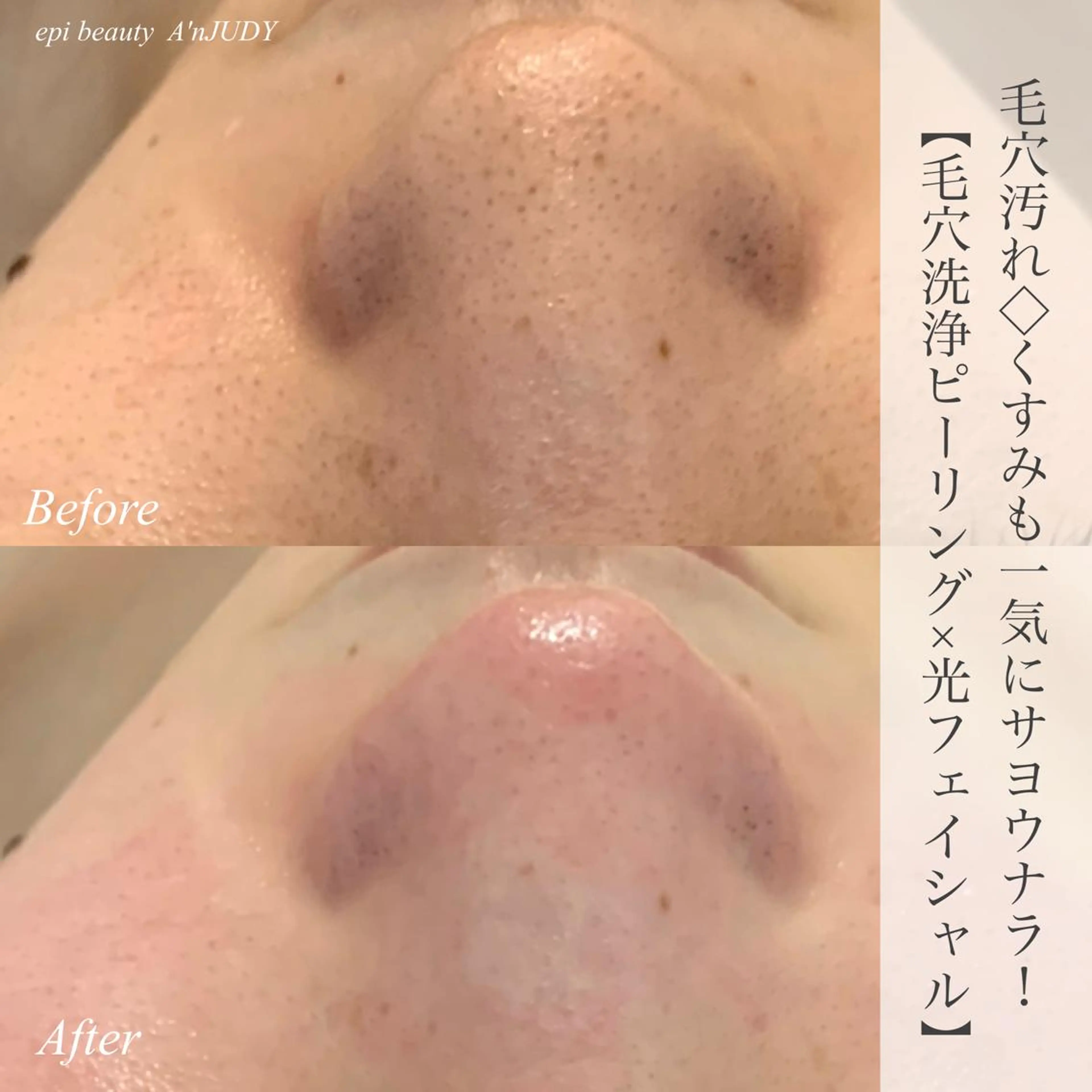 脱毛&ビューティー A'nJUDYの眉毛・アイブロウイメージ