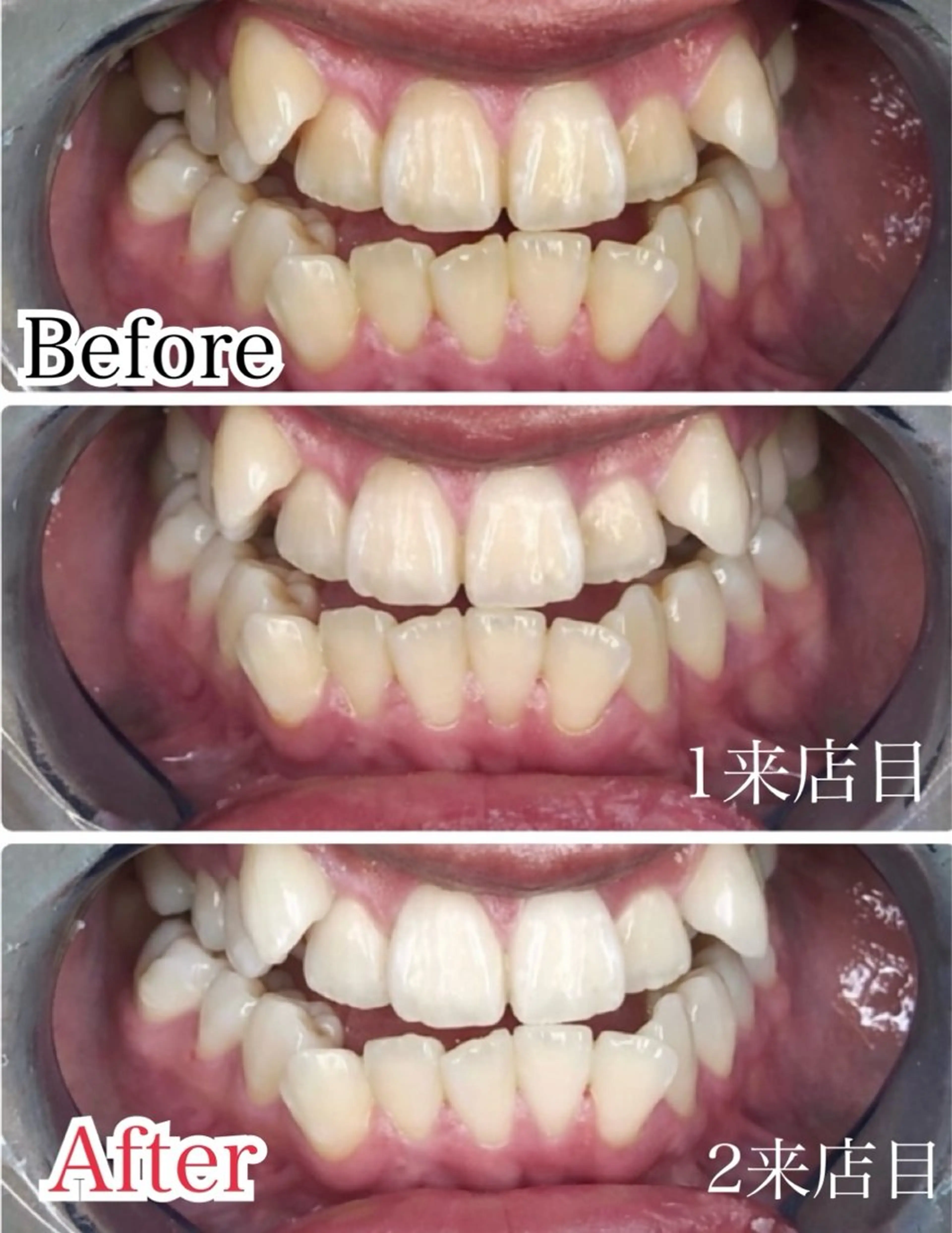 その他 プラチナムビューティー柏所属・【歯科提携】柏ホワイ トニングスタイルのその他イメージ