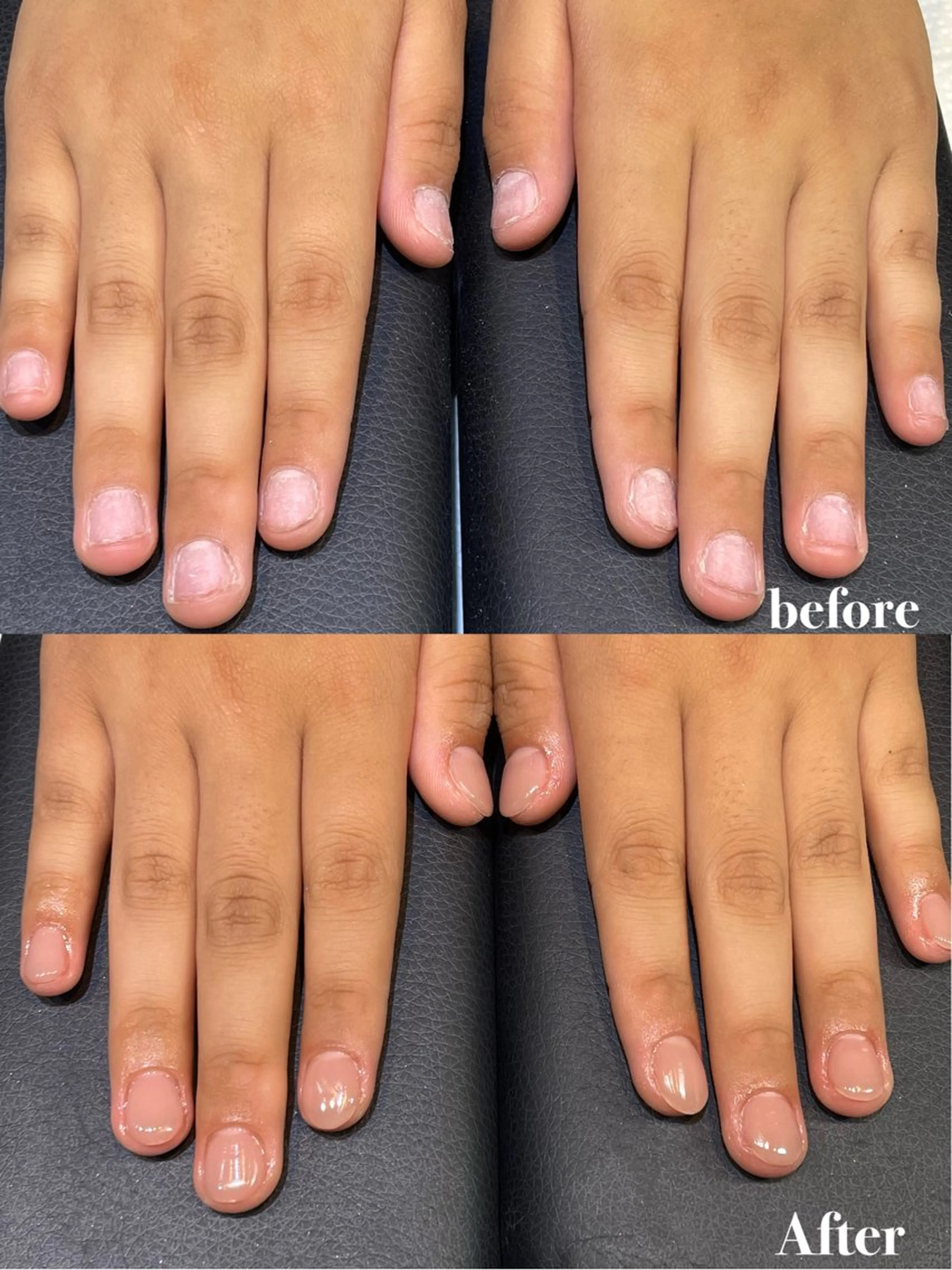 深爪矯正＋ワンカラー ホームケアオイル付きの写真