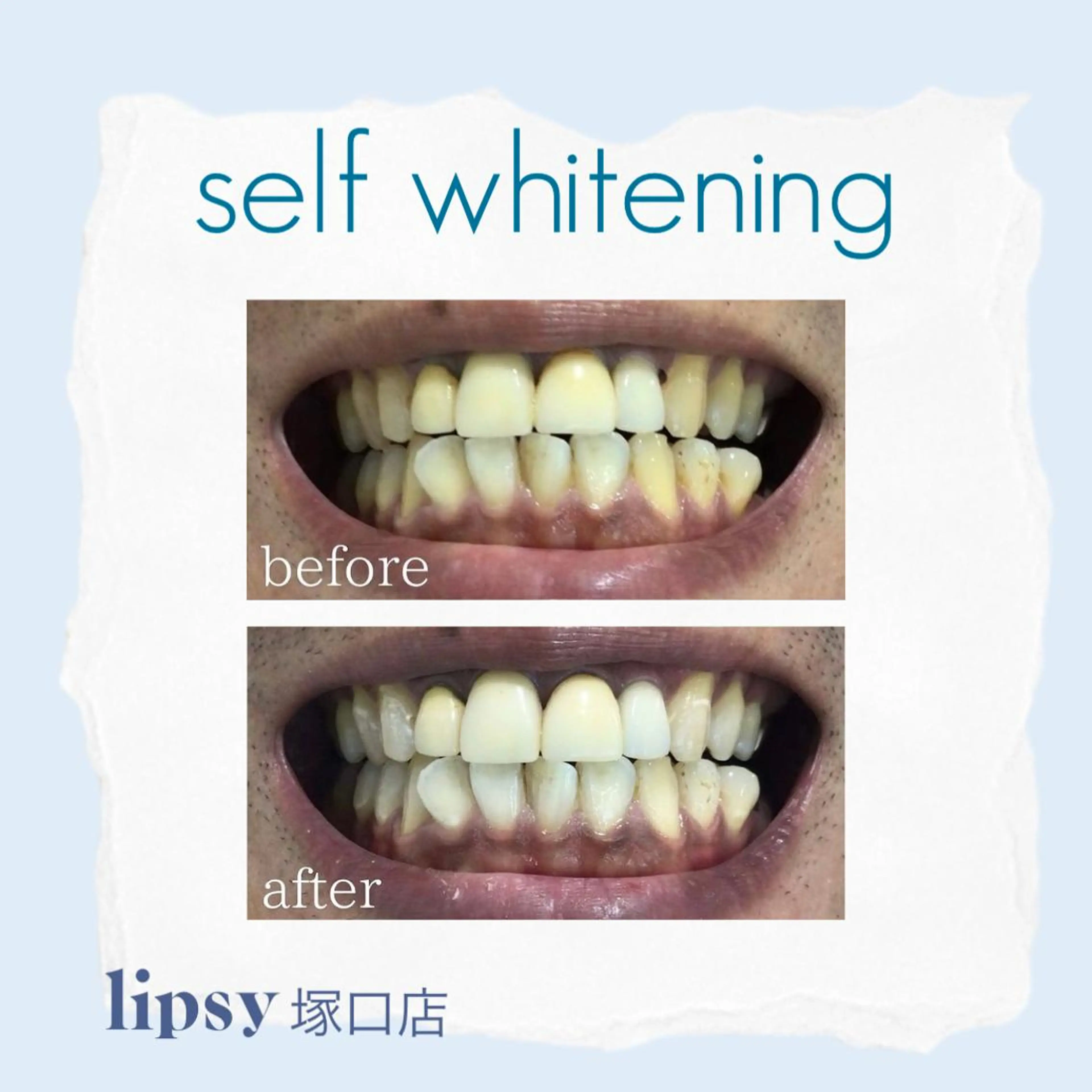 noel de mi 前川亜里沙のエステ・リラクイメージ