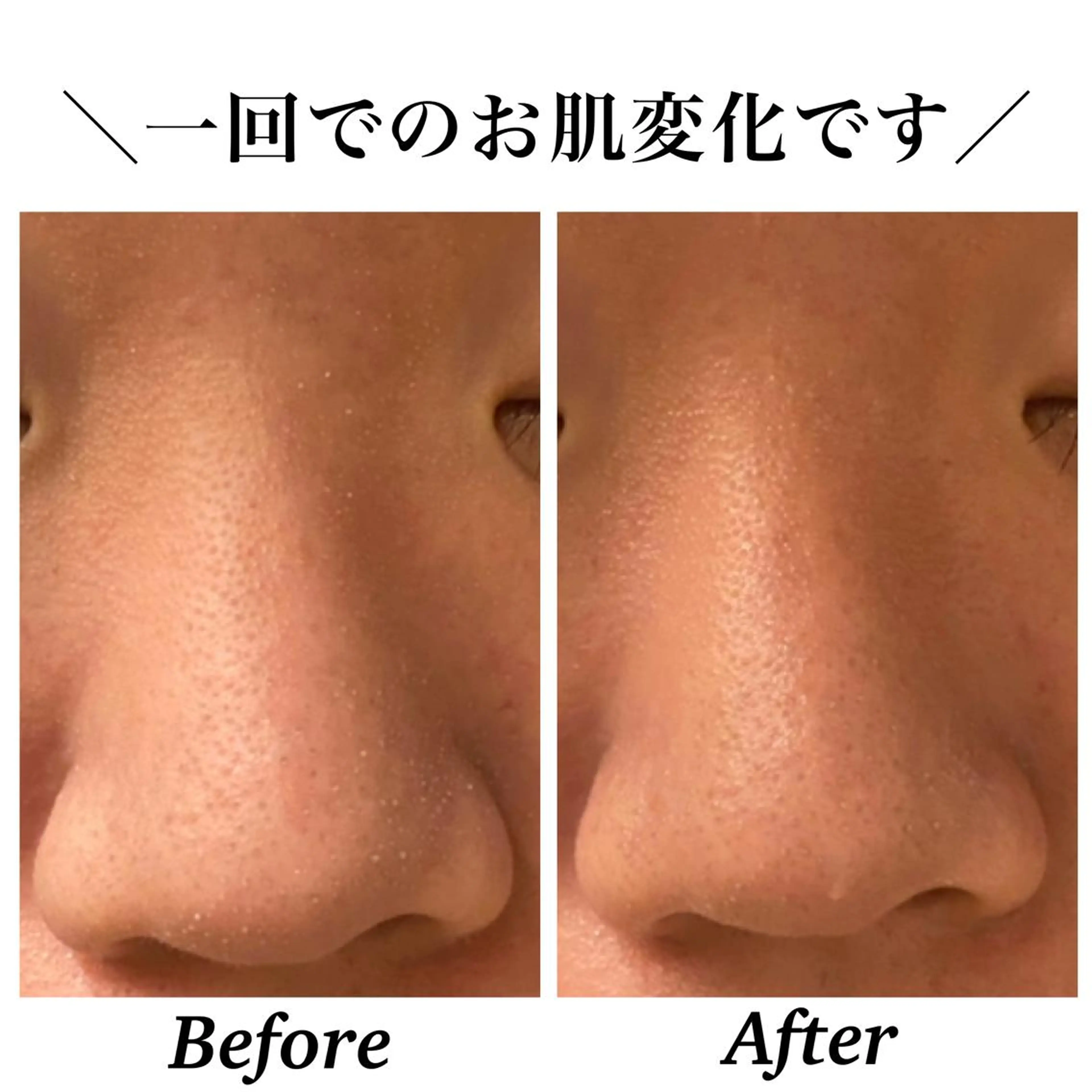 エステ リラク Bellesthe (ベルエステ)のエステ・リラクイメージ