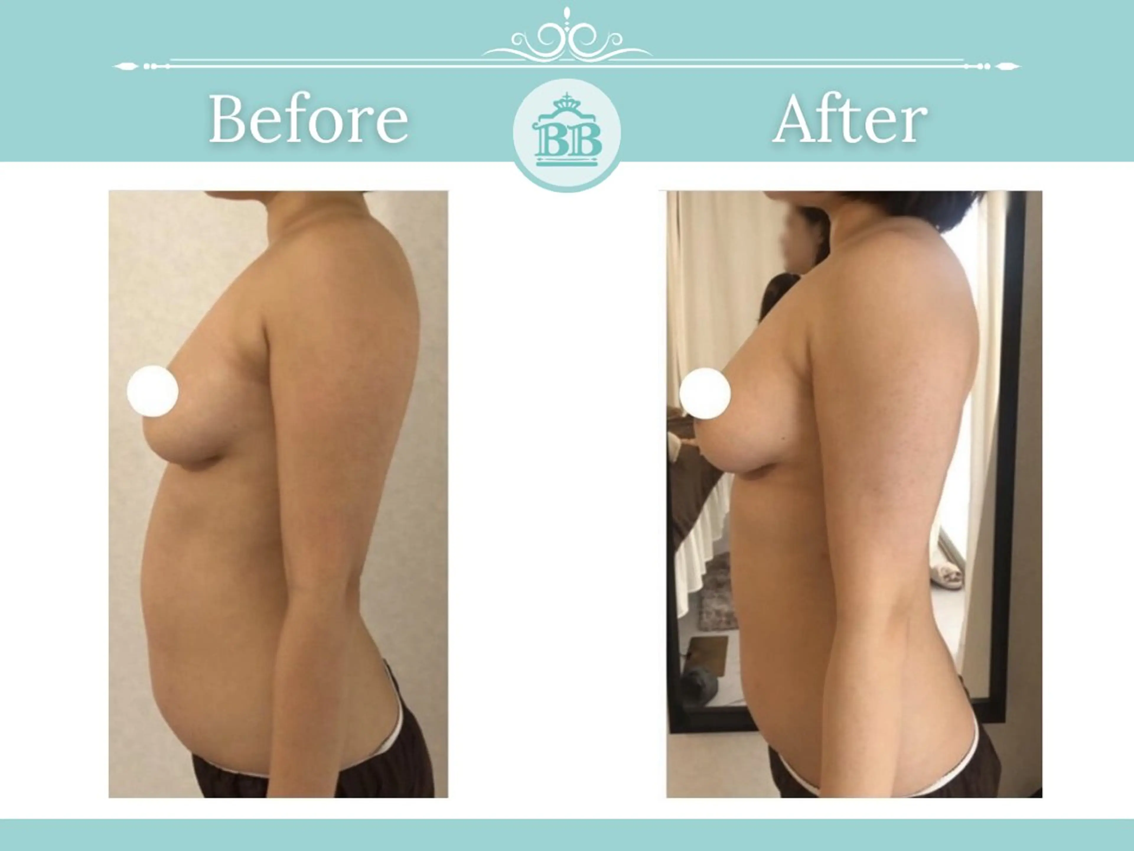 美人バスト北千住店所属・千葉 寧音のエステ・リラクイメージ