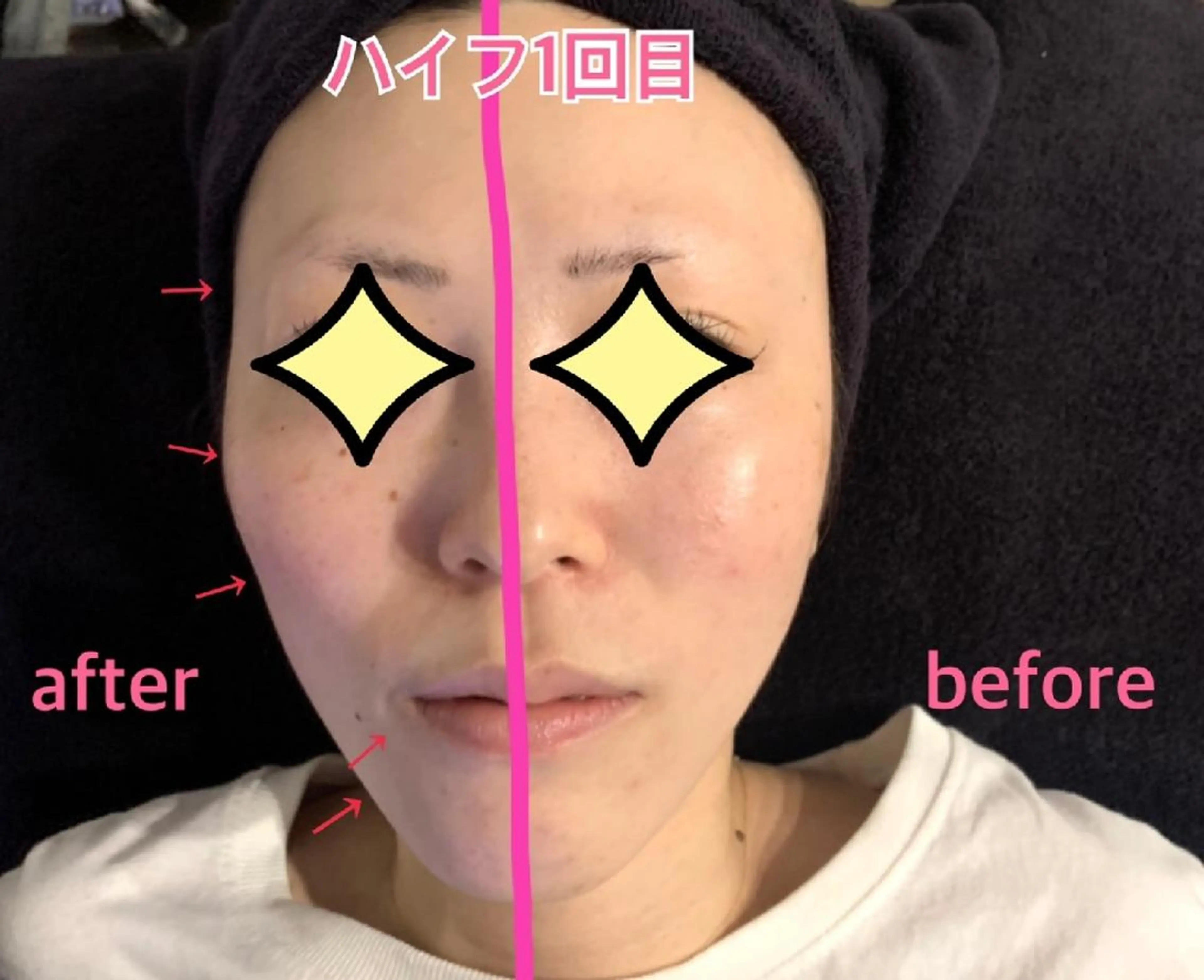 SESUNNY セサニー SEIRAのマツエク・マツパデザイン