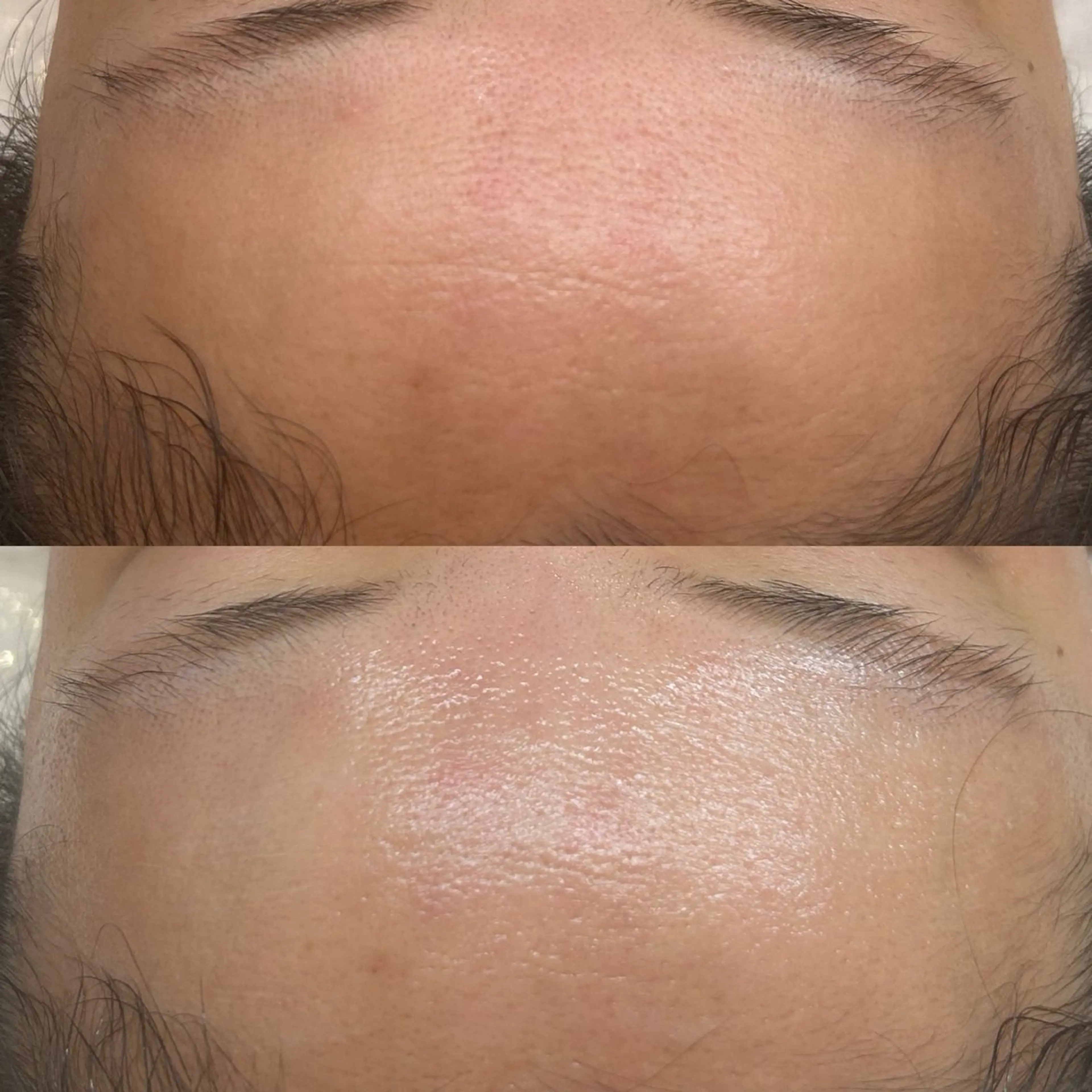 エステ 韓国🇰🇷価格 サロン_Nbibiのエステ・リラクイメージ