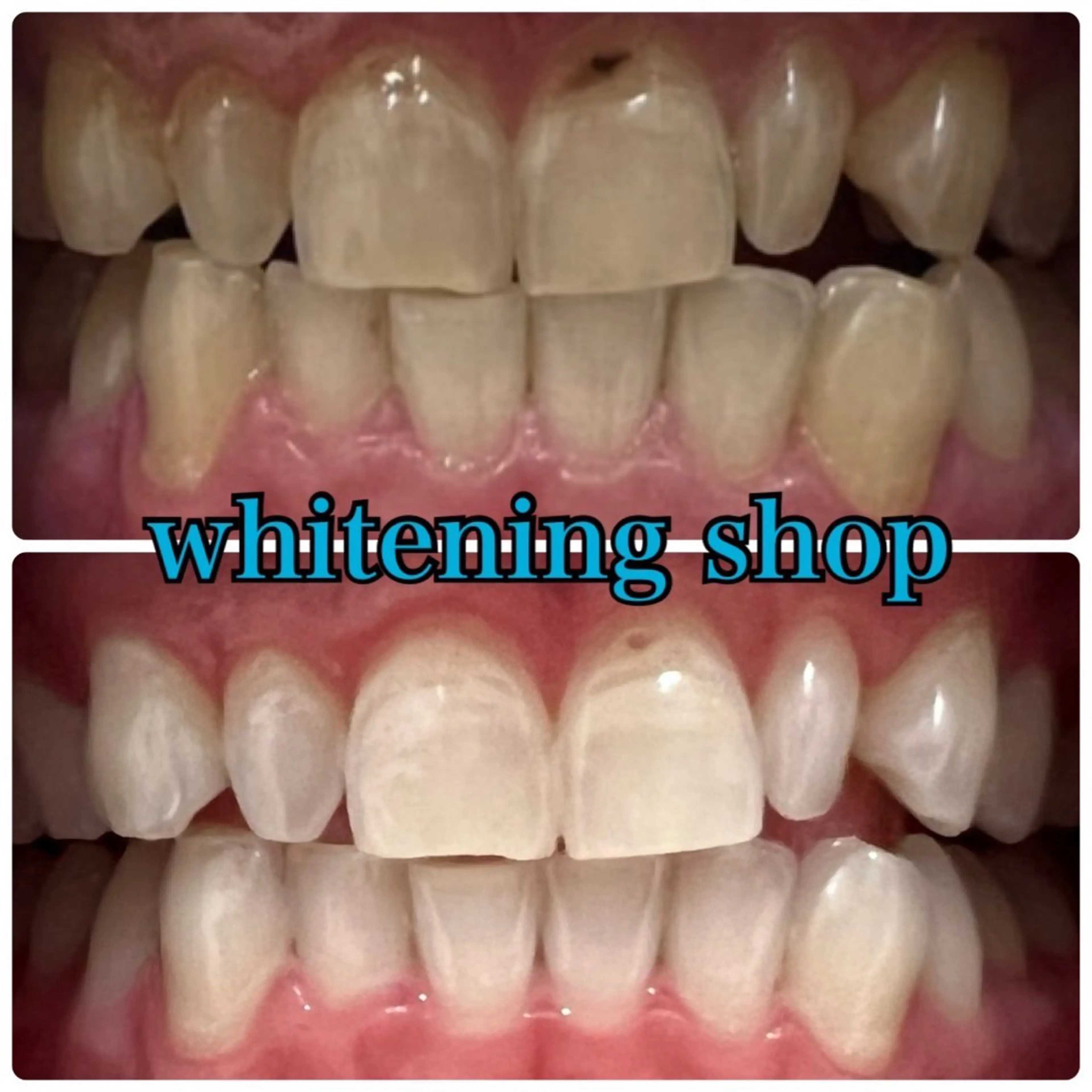 ホワイトニングショップ津店所属・ホワイトニング ショップ津店のその他イメージ