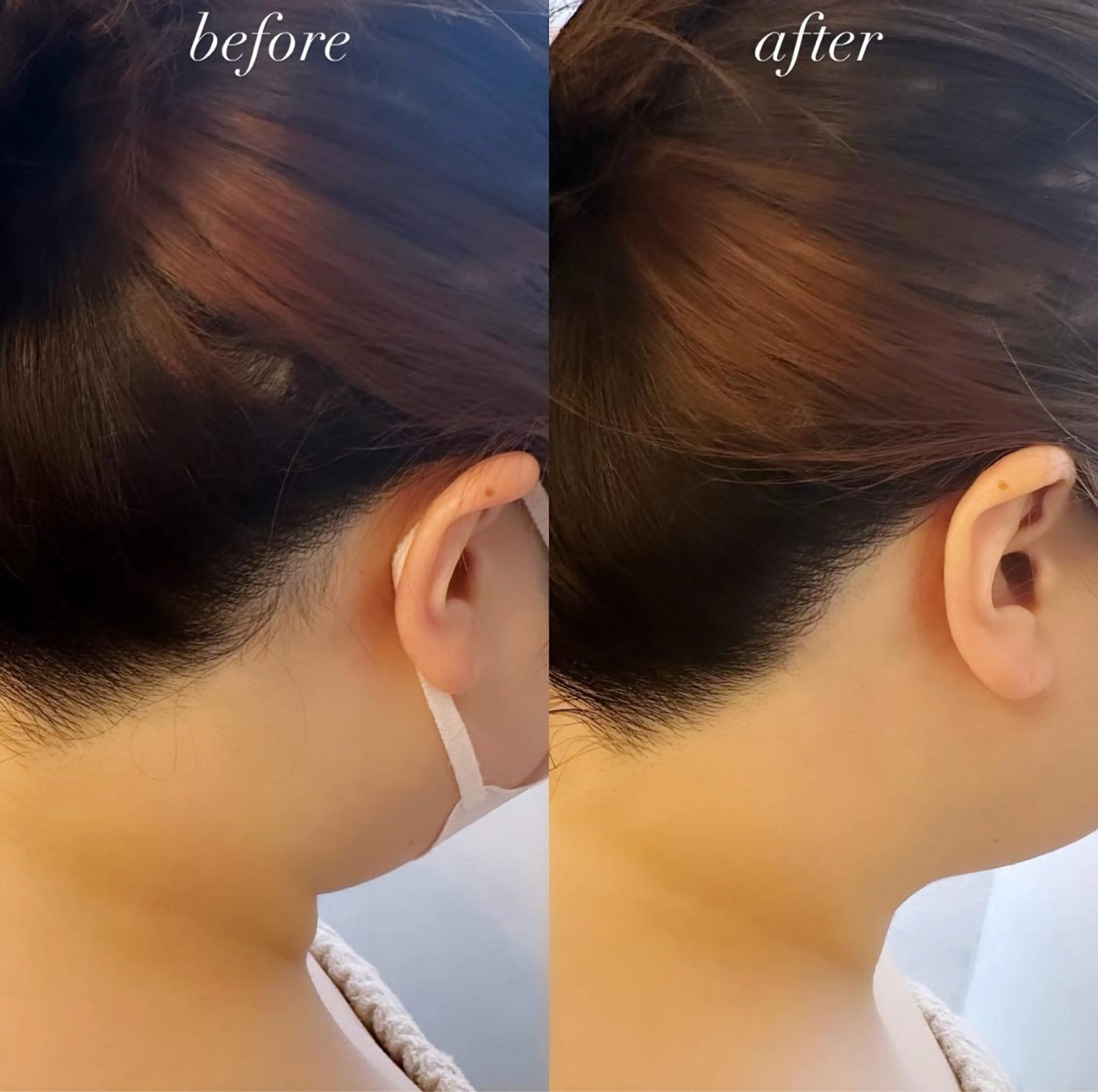 うなじ脱毛/美肌脱毛 LABELのエステ・リラクイメージ