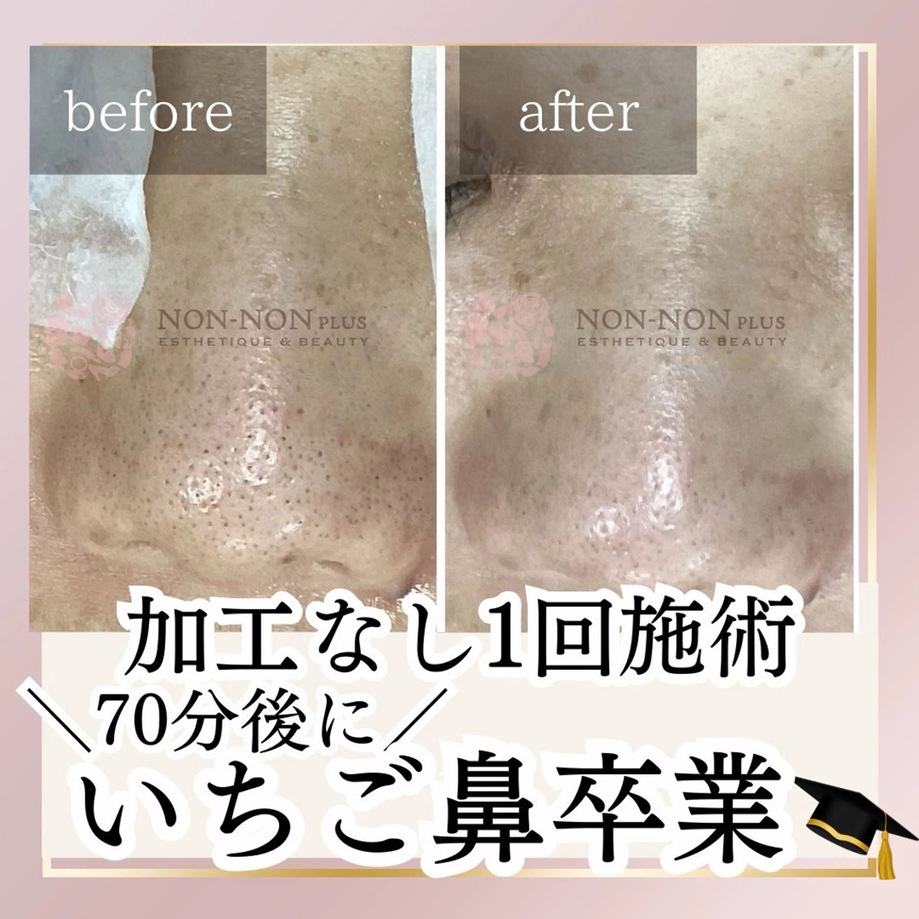 NON-NONプラス 博多のエステ・リラクイメージ