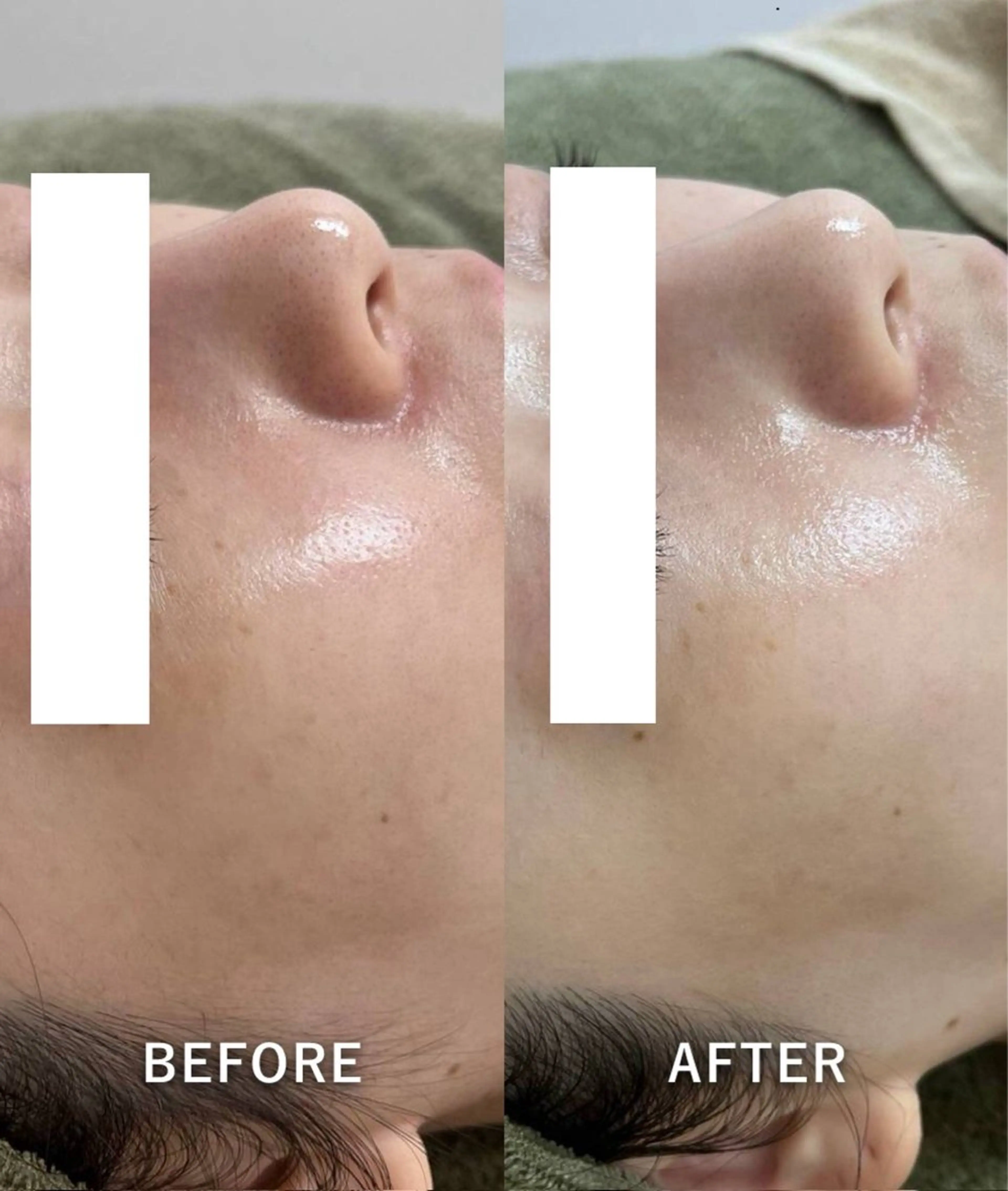 エステ 韓国美肌/肌質改善 【天神】yuiのエステ・リラクイメージ