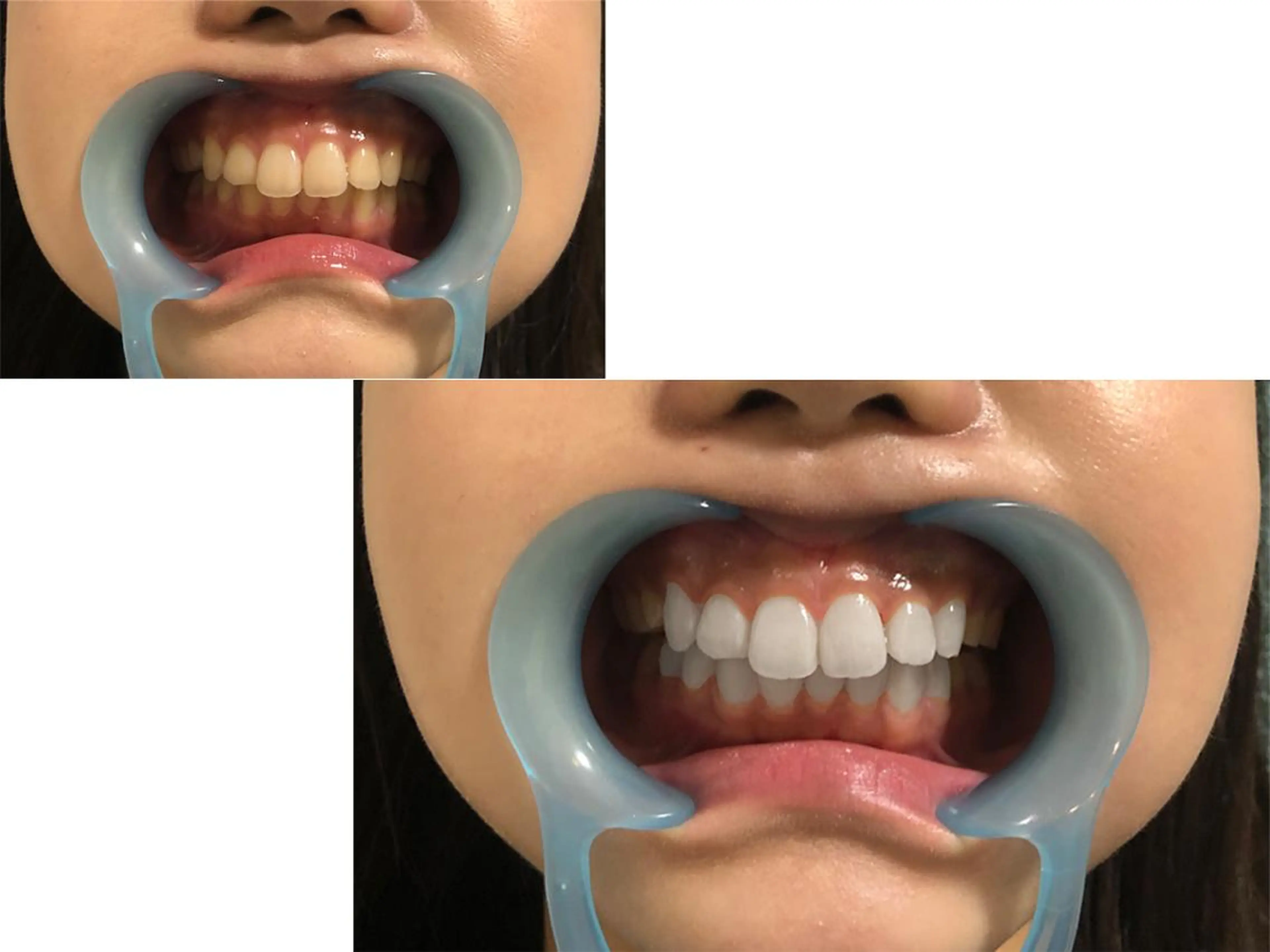 アイブロウ マツエク・マツパ ネイル キッズ カラー パーマ ヘアアレンジ メンズ ホワイト その他 中目黒 ホワイトニングサロンのその他イメージ