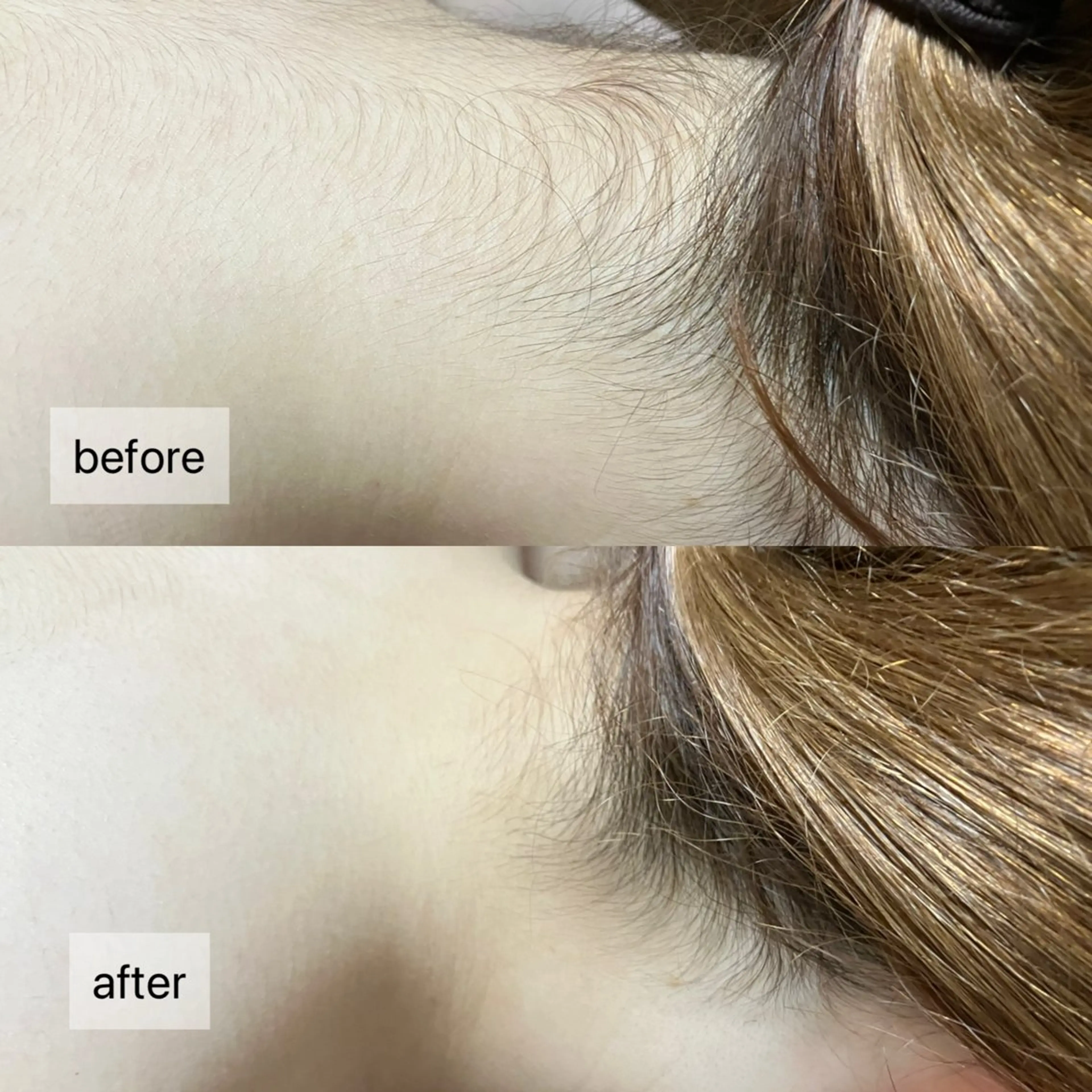 HINANO矢場町店【ヒナノ】所属・脱毛/肌改善🌿 HINANO 村田のエステ・リラクイメージ