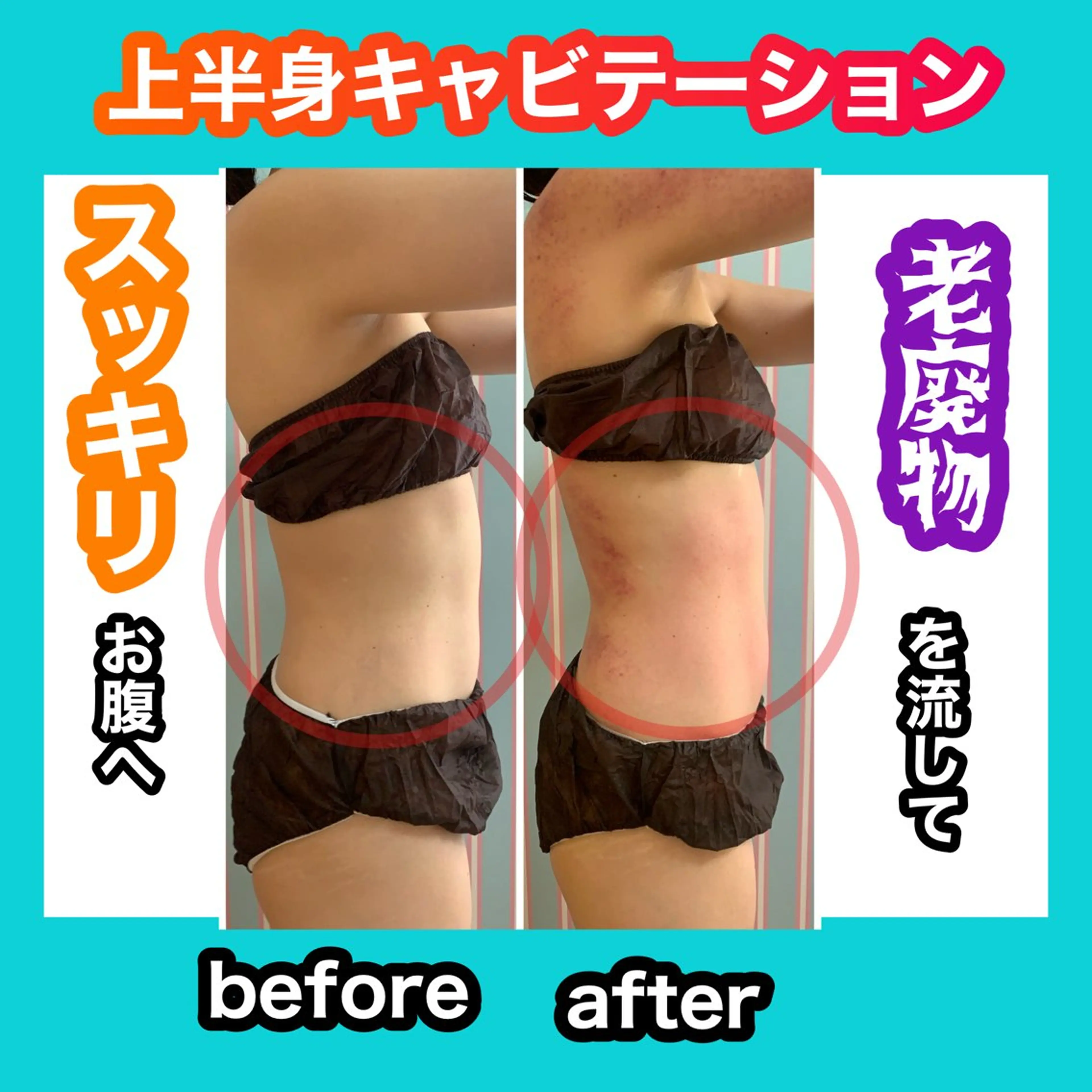 エステ リラク 痩身/脱毛/ネイル HARUKAのエステ・リラクイメージ