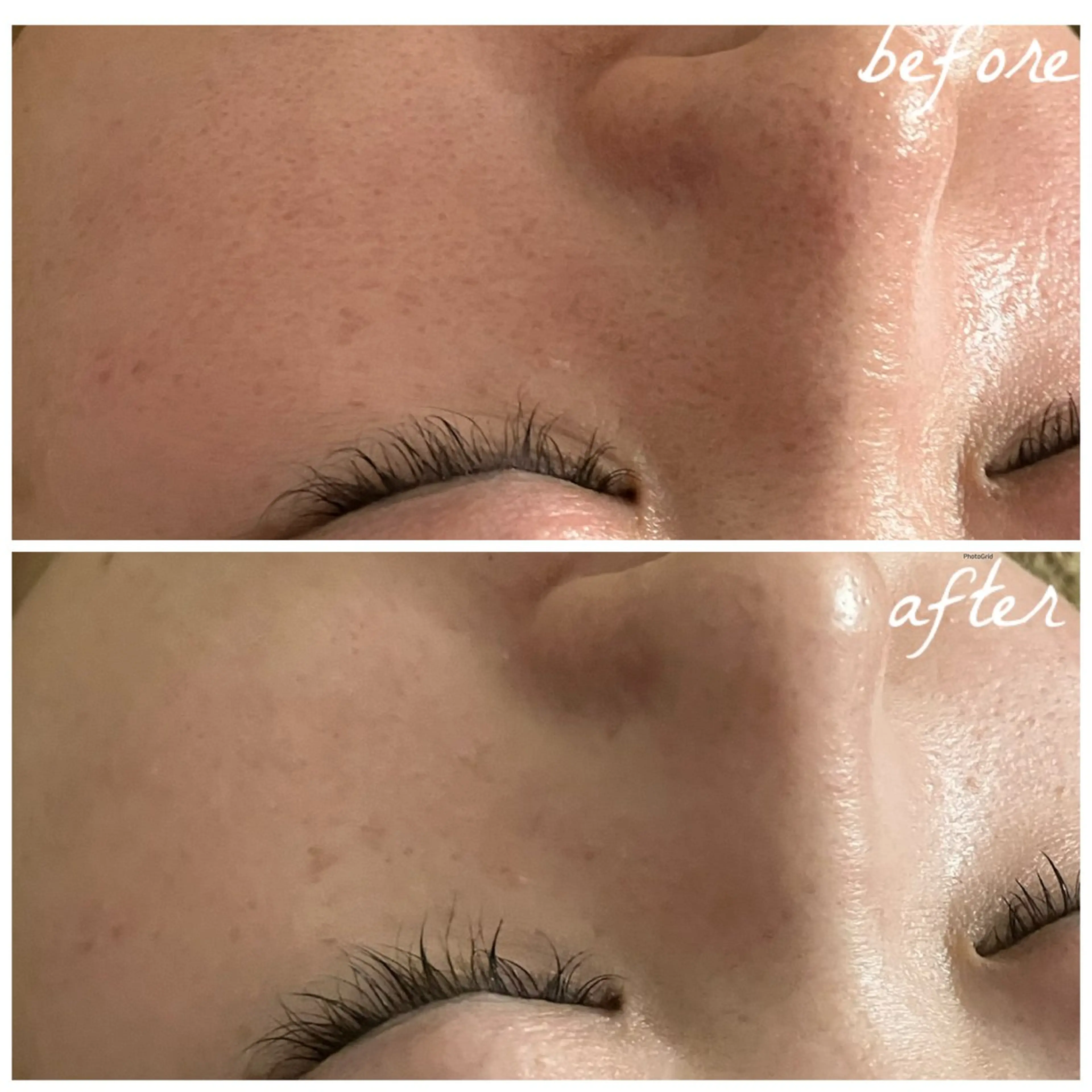 メンズ エステ メナード岐阜市茜部 杉浦のエステ・リラクイメージ