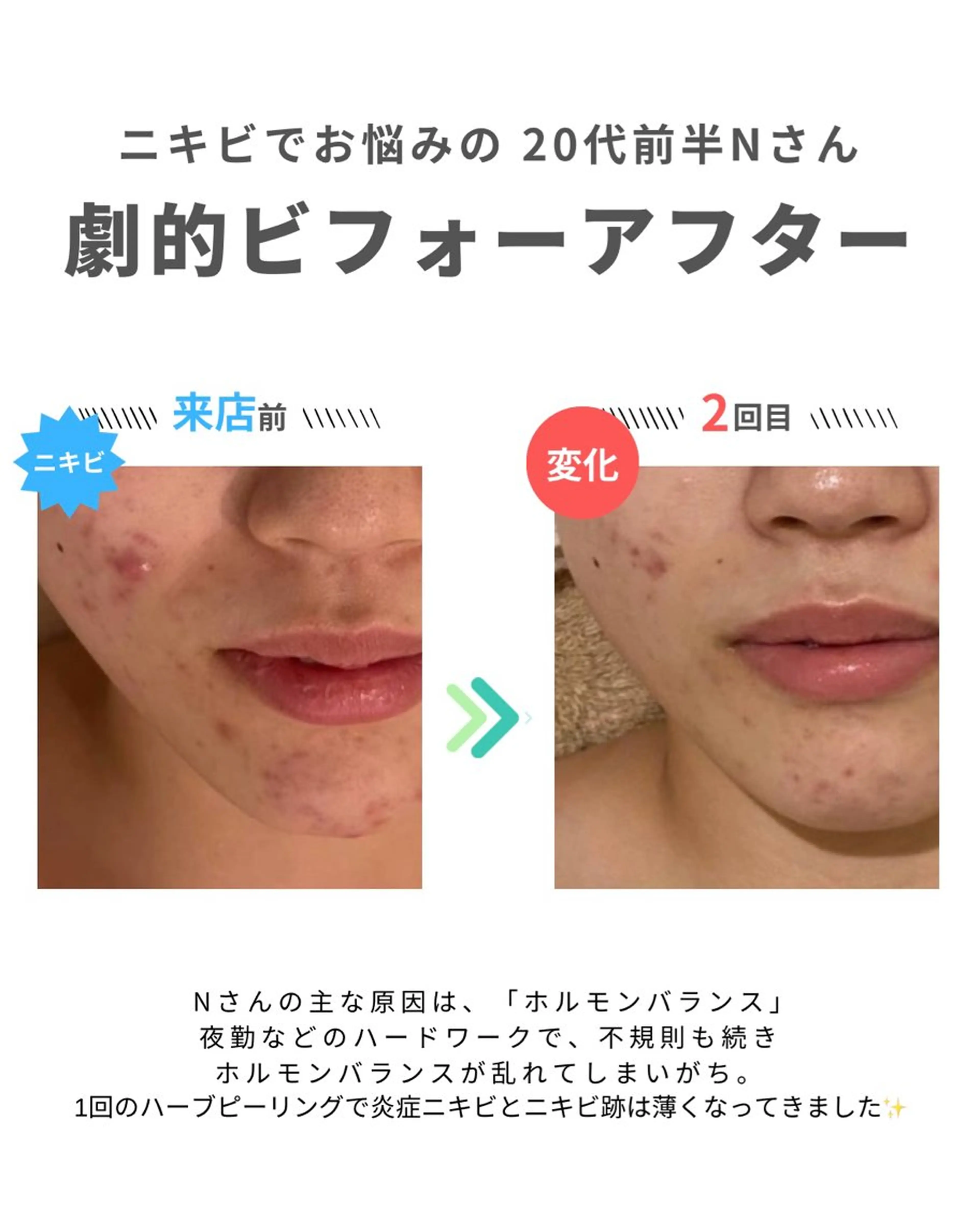 エステ 舟橋 優衣のエステ・リラクイメージ