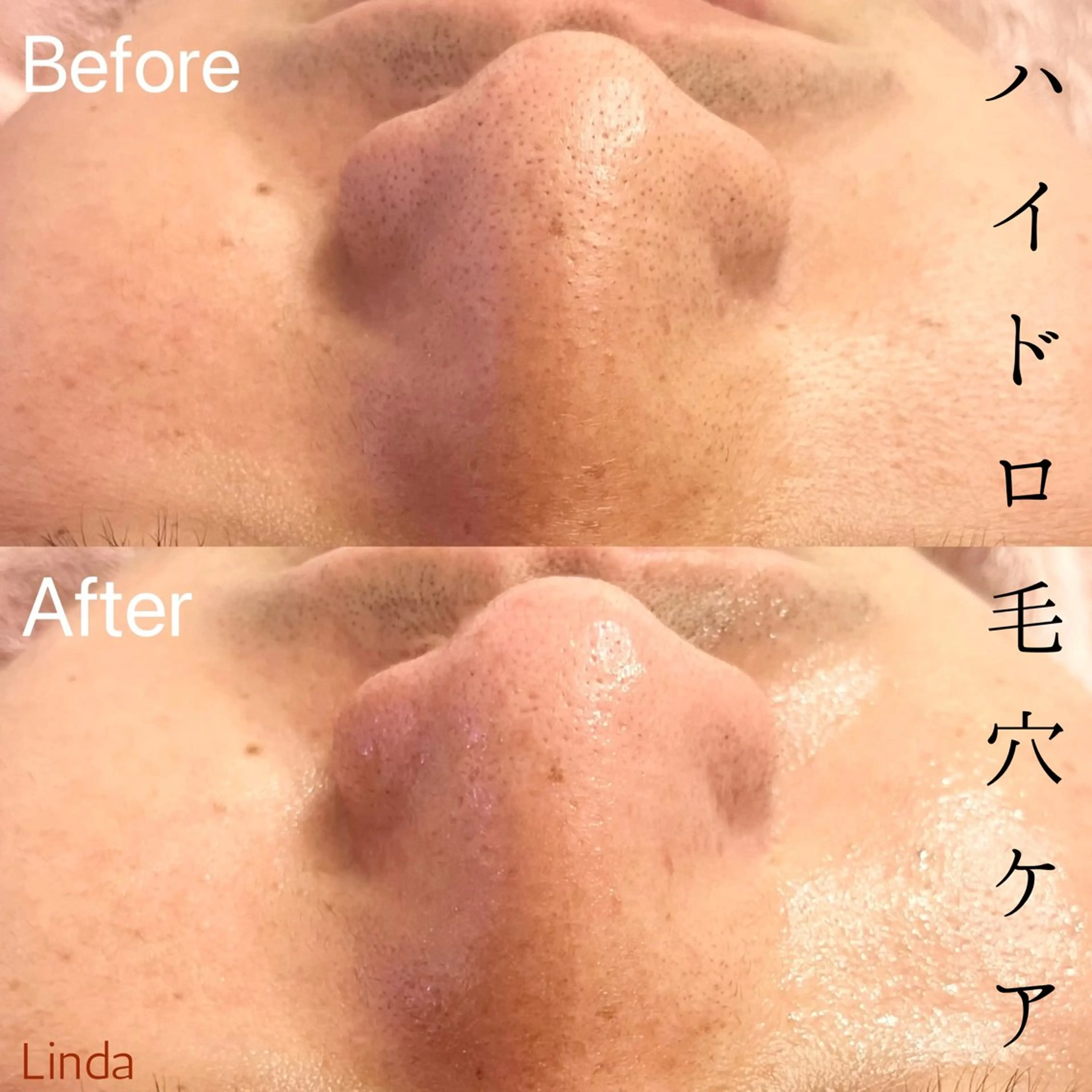 その他 アイラッシュ&エステサロンLinda西宮所属・小顔&毛穴・肌質改善 LINDA西宮 AIのエステ・リラクイメージ