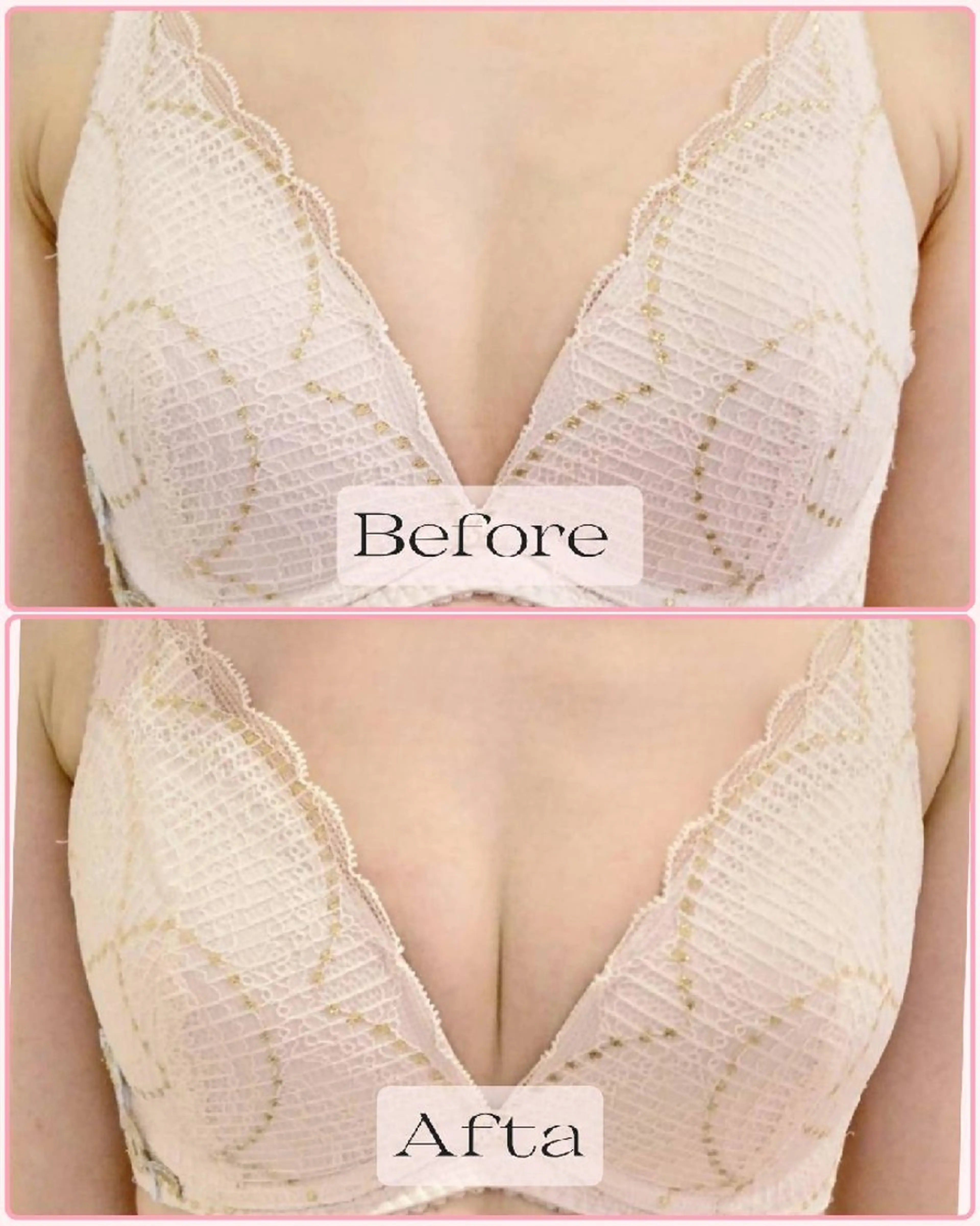 エステ マシュマロバスト coucouのエステ・リラクイメージ