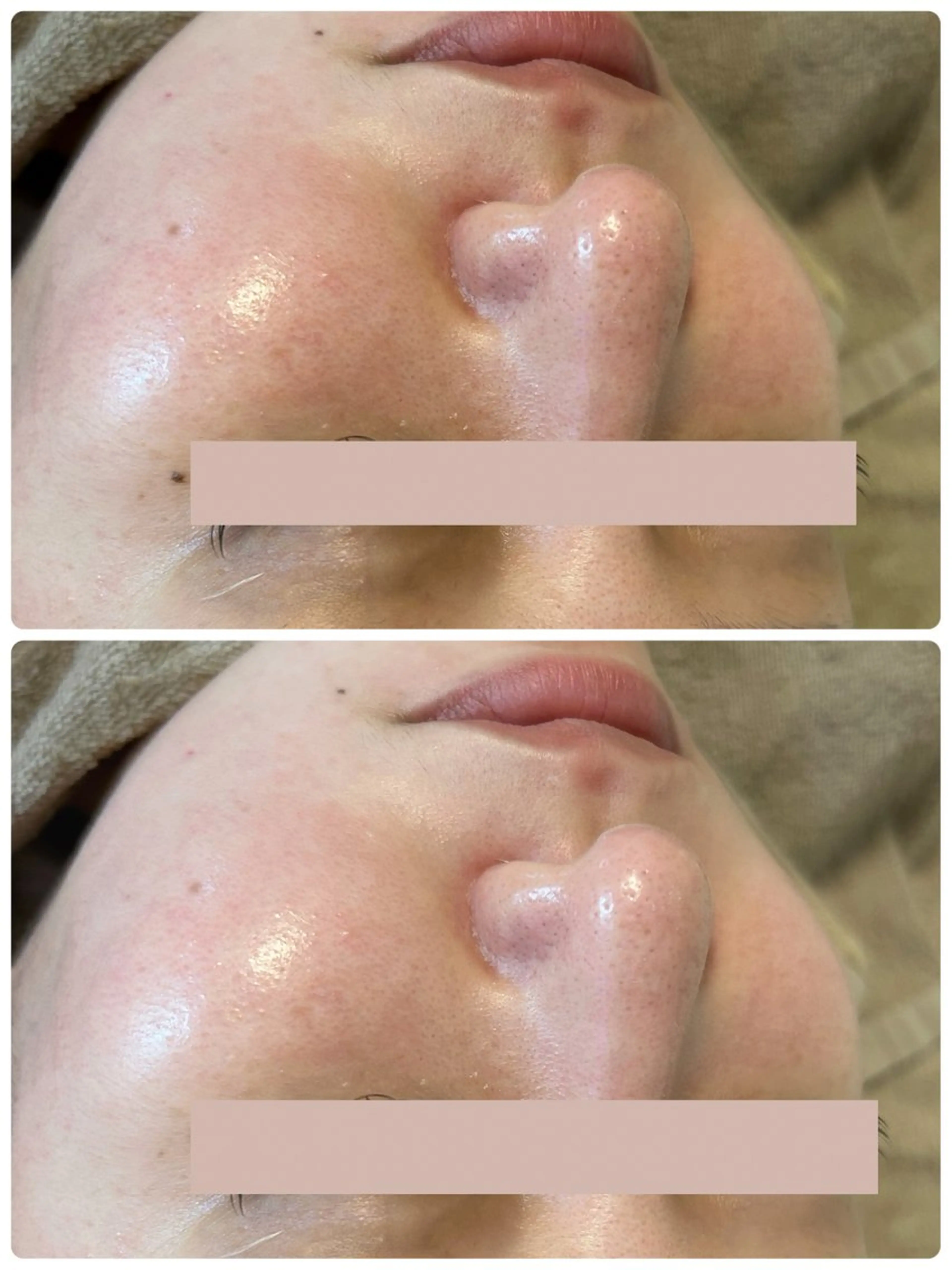 脱毛 Beauty salon Wish所属・脱毛🌈肌質改善🌈 Wishのエステ・リラクイメージ