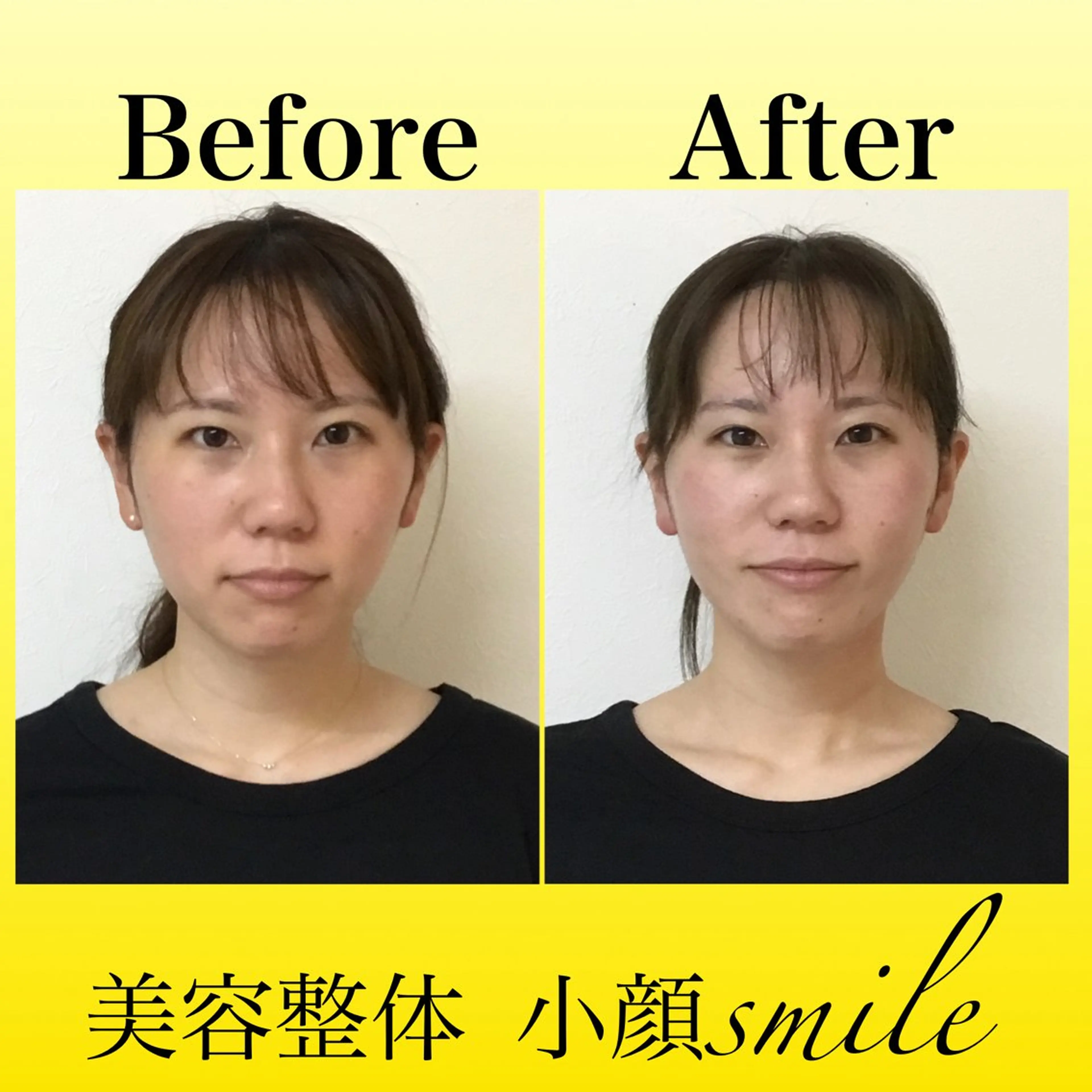 エステ リラク 【小顔矯正専門】 小顔smileのエステ・リラクイメージ