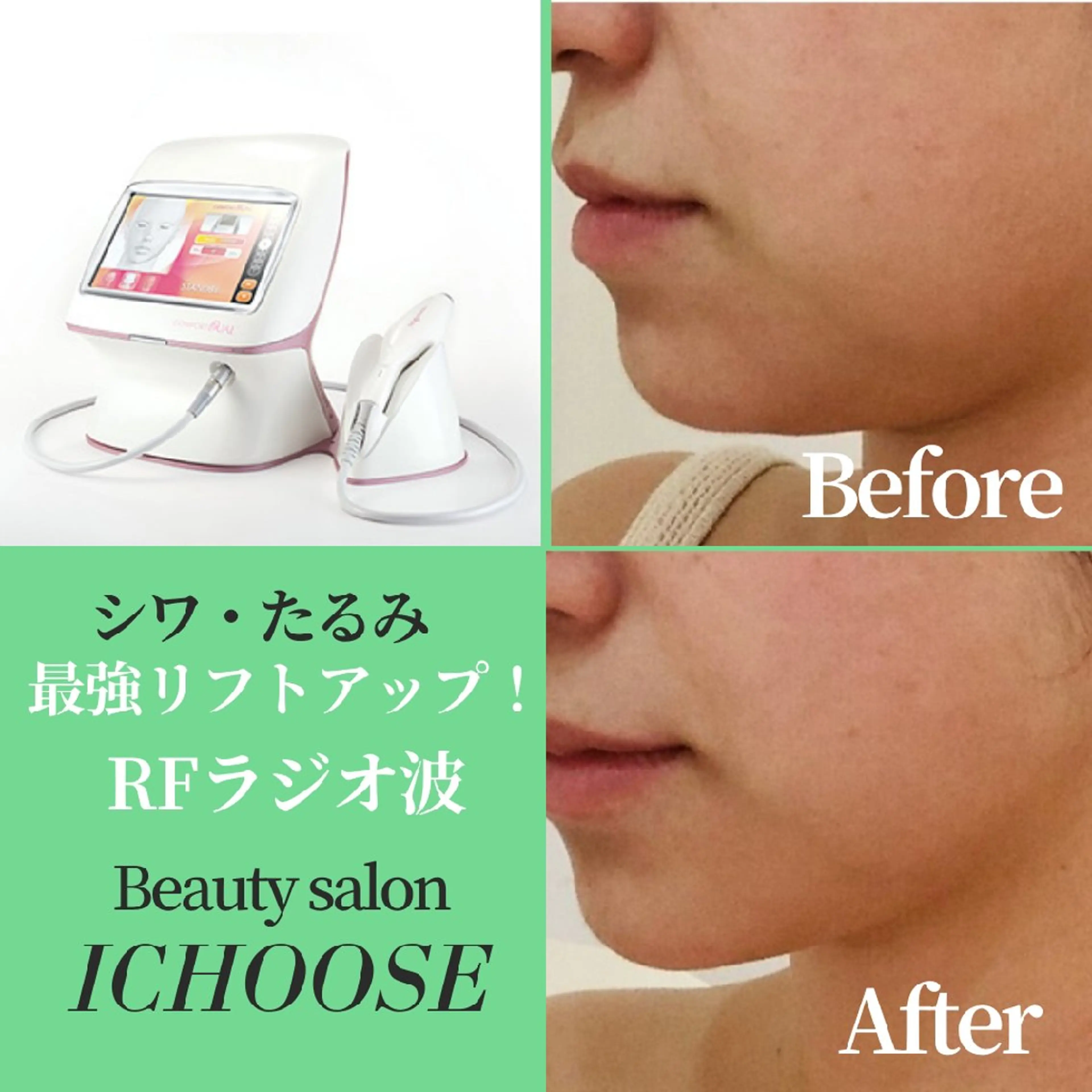 ICHOOSE/ 代々木上原のエステ・リラクイメージ