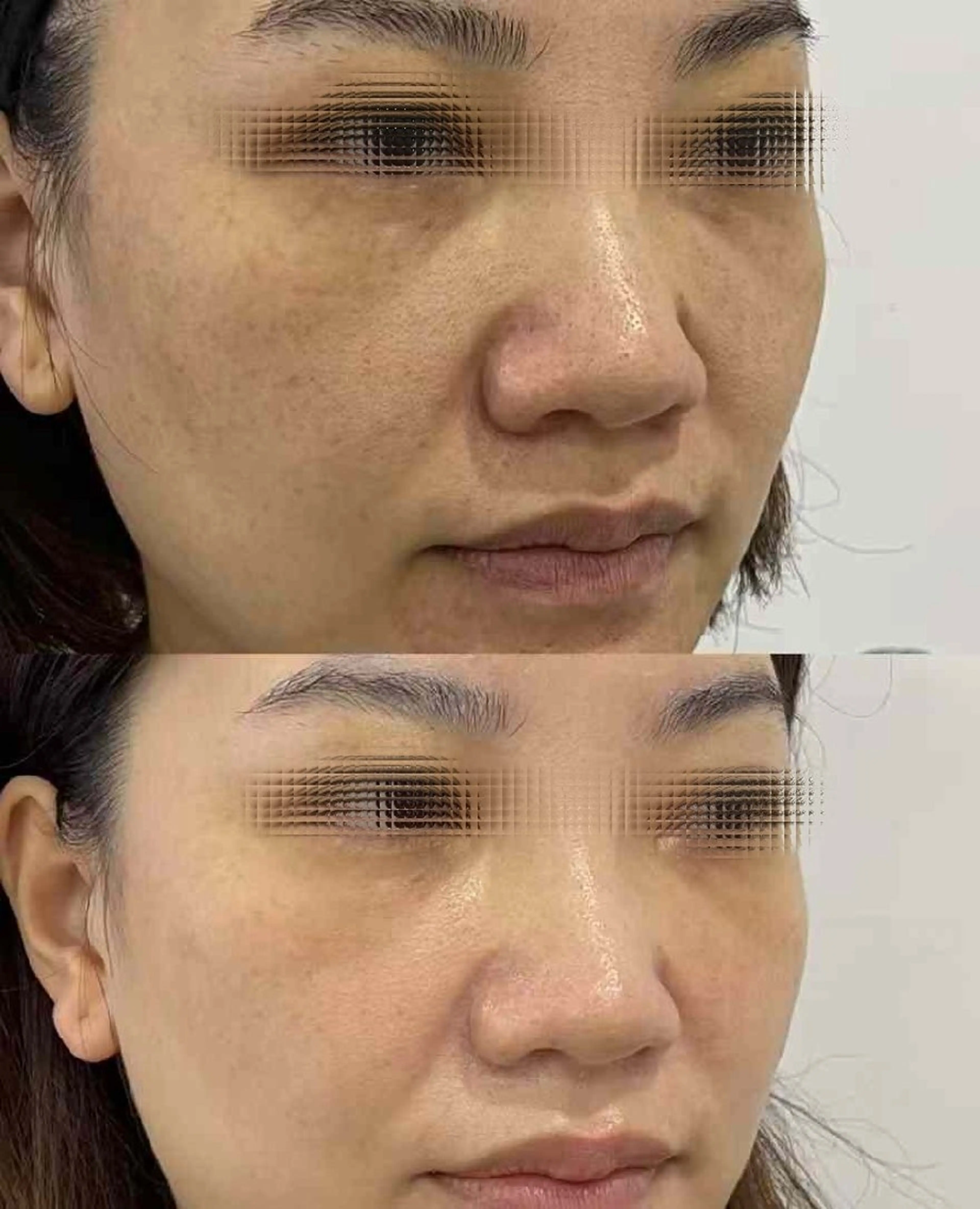 ネイル ブライダルネイル ホワイト aliaハイフ&水光ジェットサロン所属・aliaハーブ水光店 エステティシャン募集のエステ・リラクイメージ