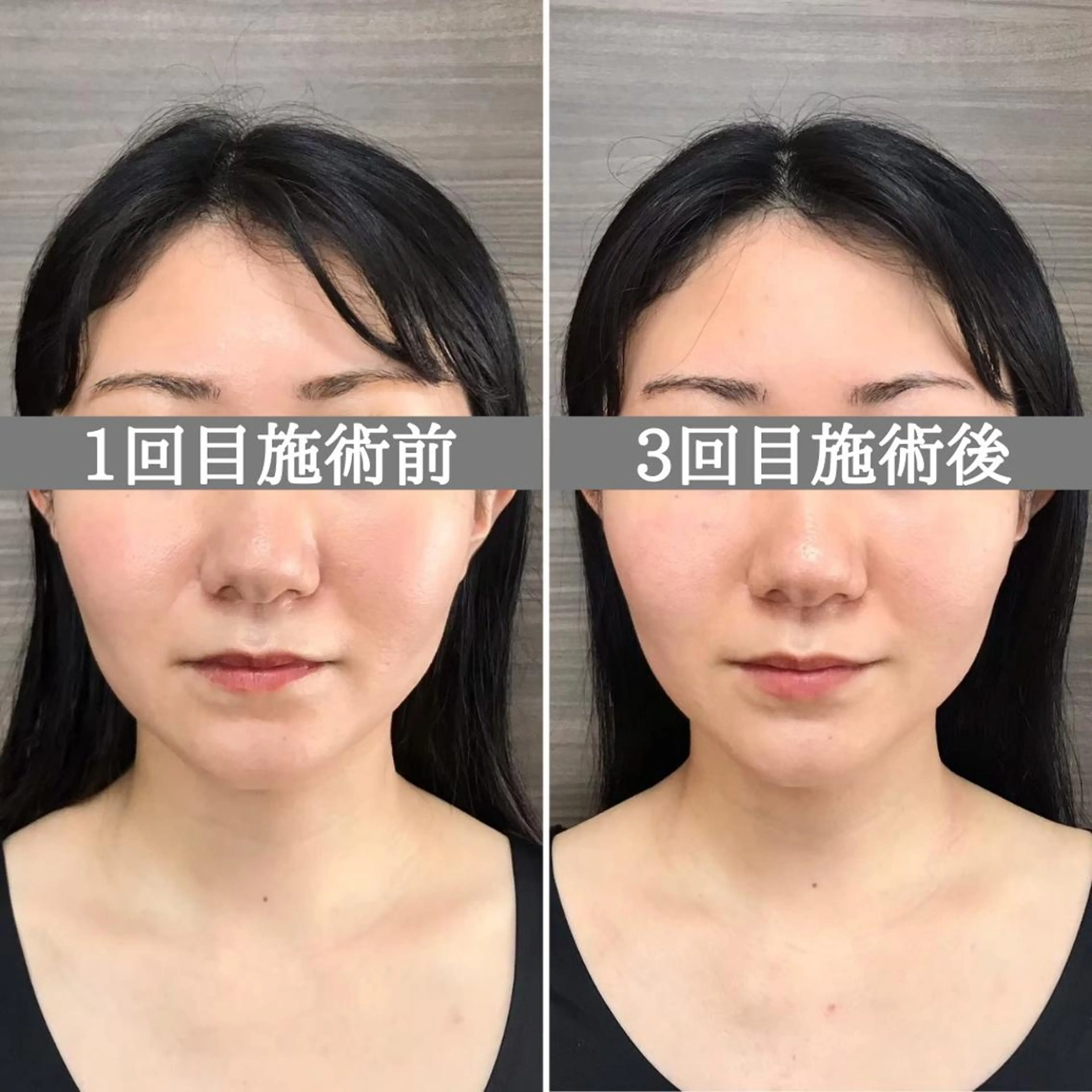 エステ リラク 美容整体サロン Chare人形町店のエステ・リラクイメージ