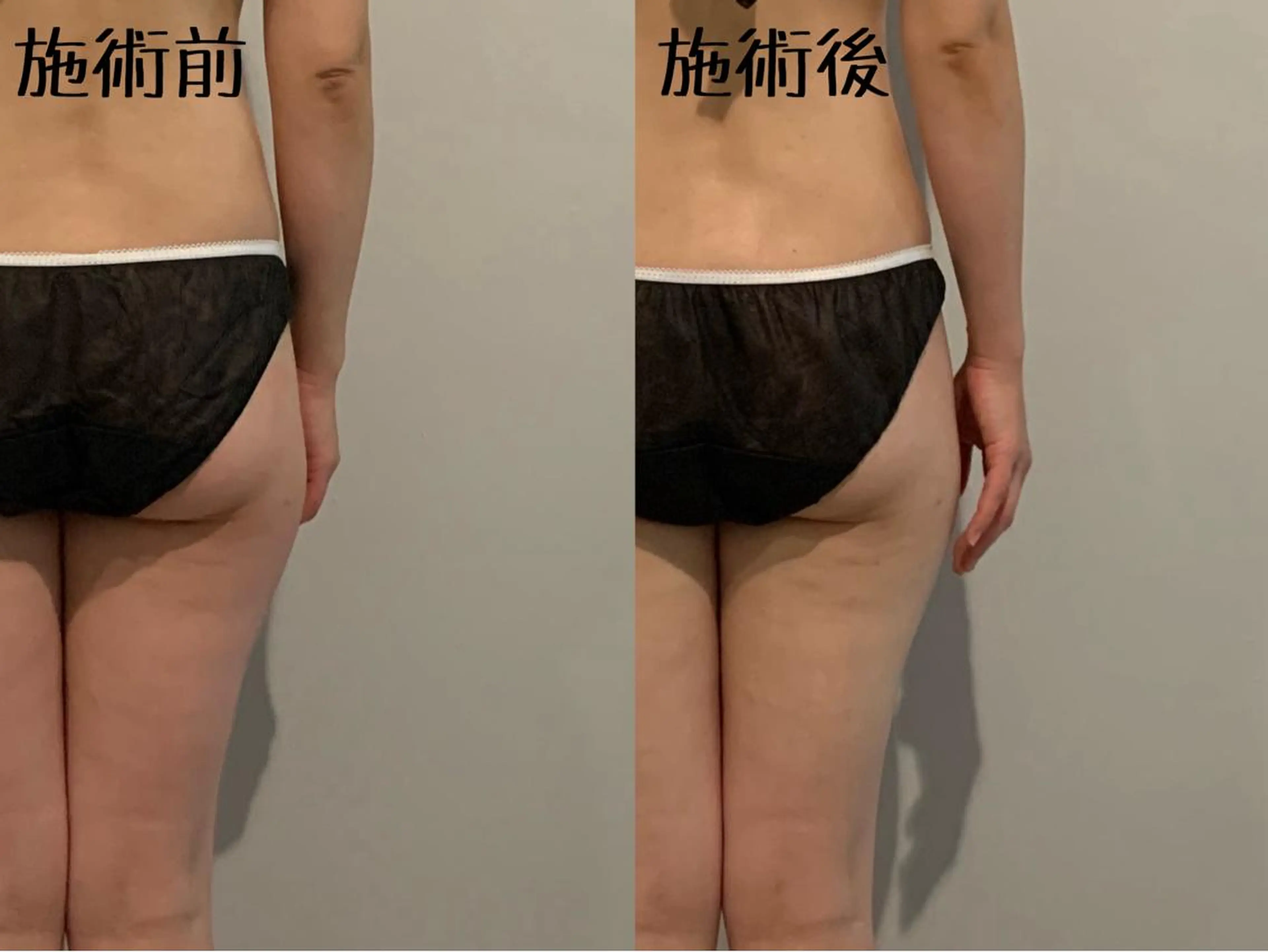 maintenance salon shinoma所属・ボディメンテナンス shinomaのエステ・リラクイメージ