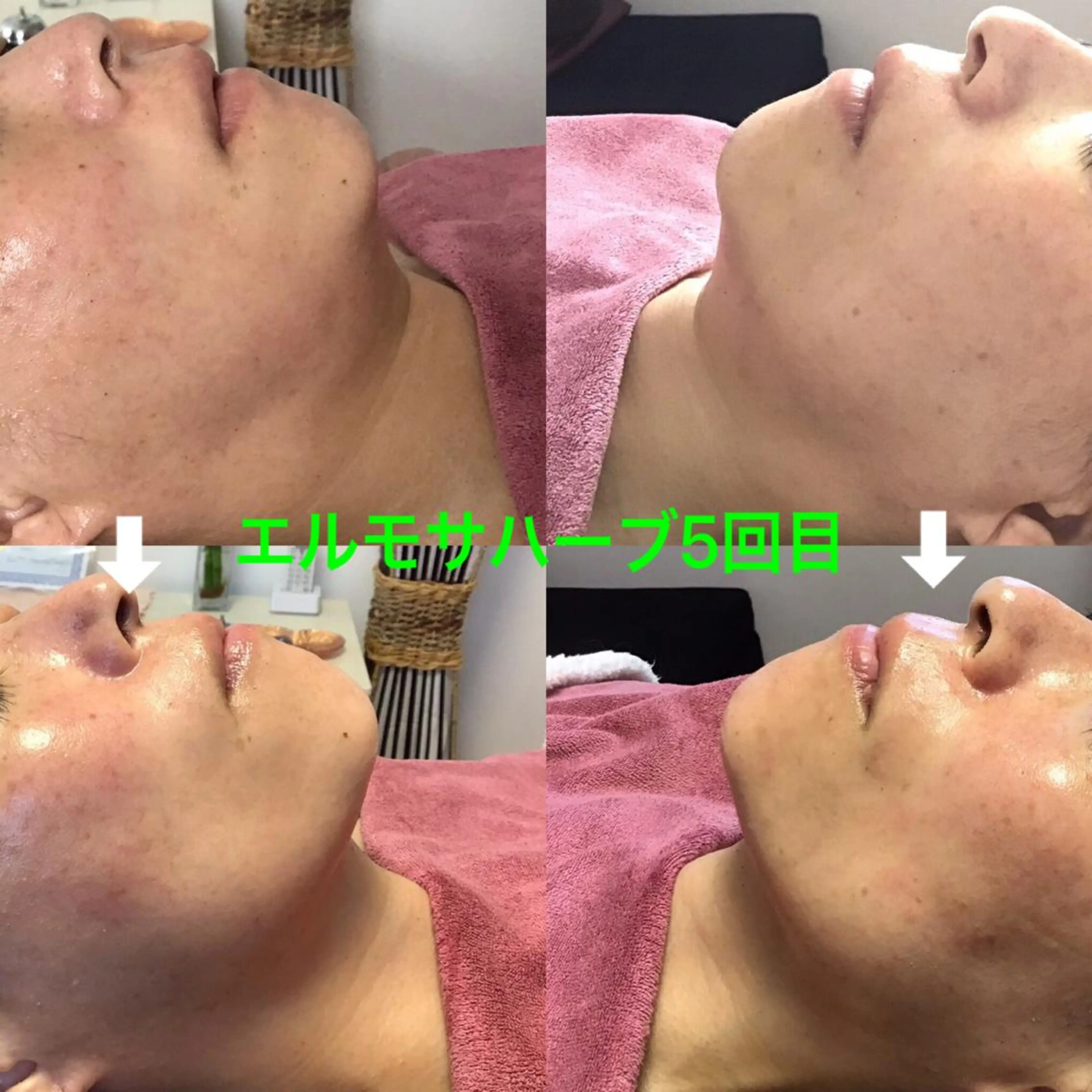 エステ 氣楽所属・松下 さゆりのエステ・リラクイメージ