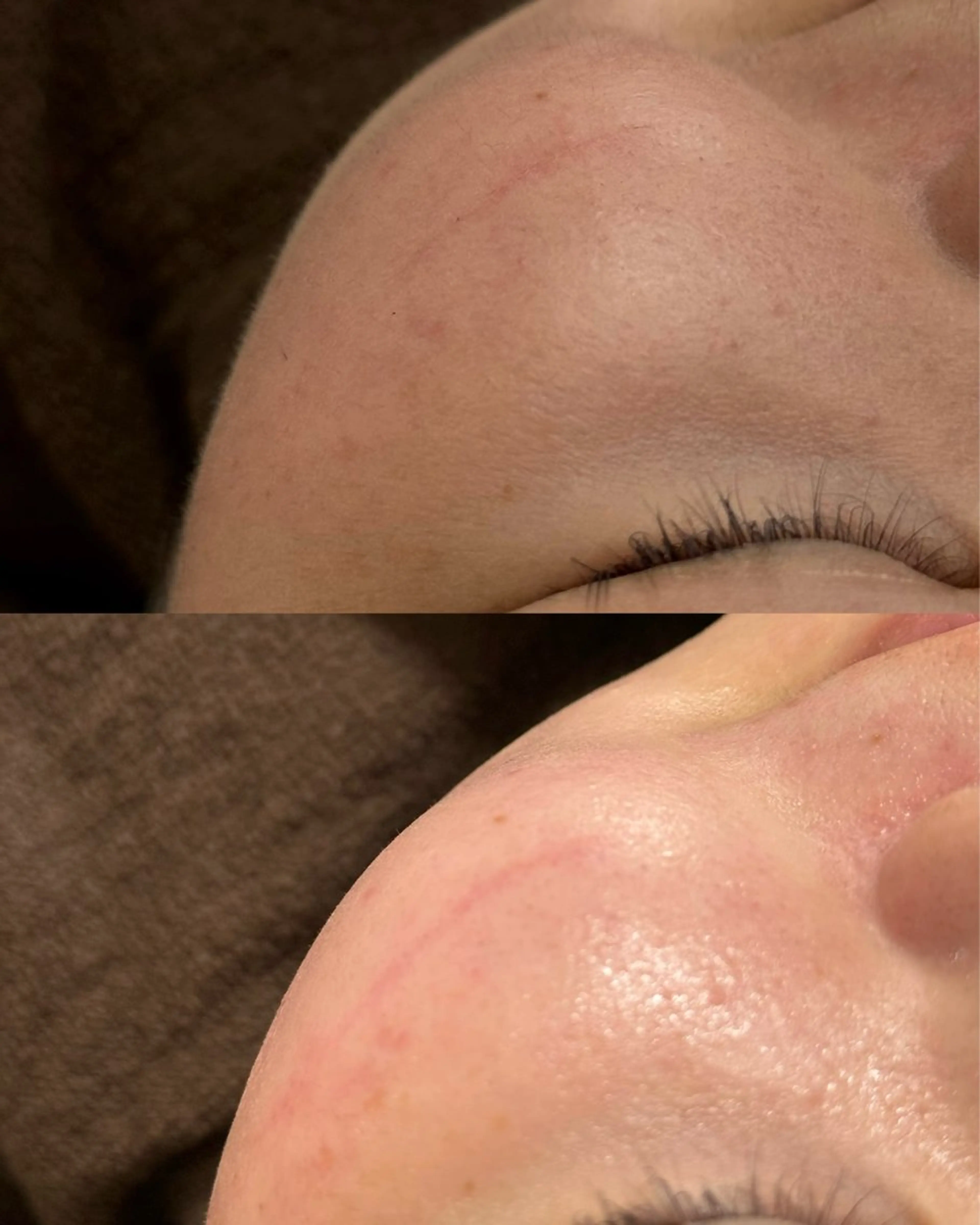 エステ Écrinna所属・Écrinna eyelashのマツエク・マツパデザイン