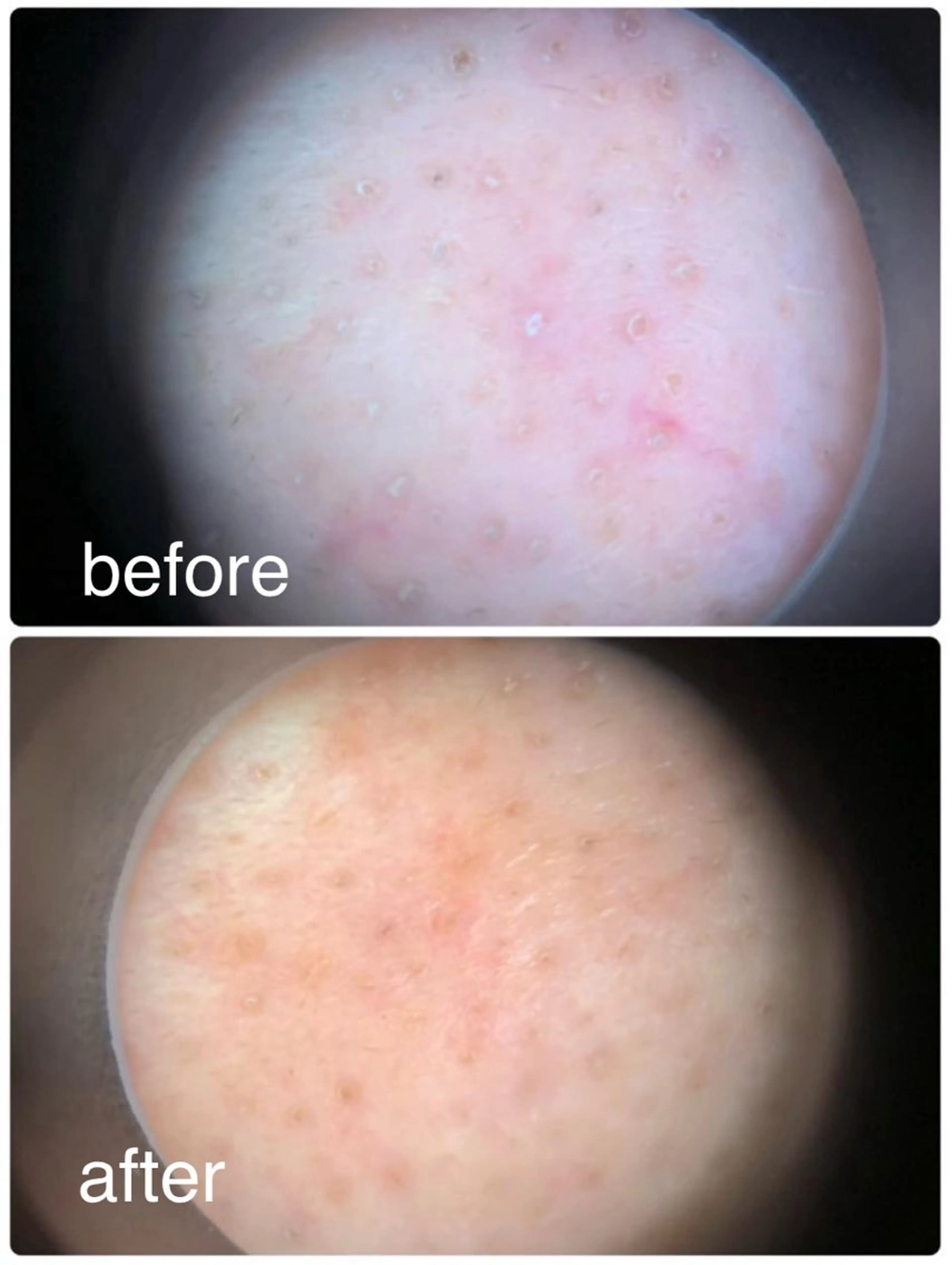 フェイシャル首肩ケアコースの写真