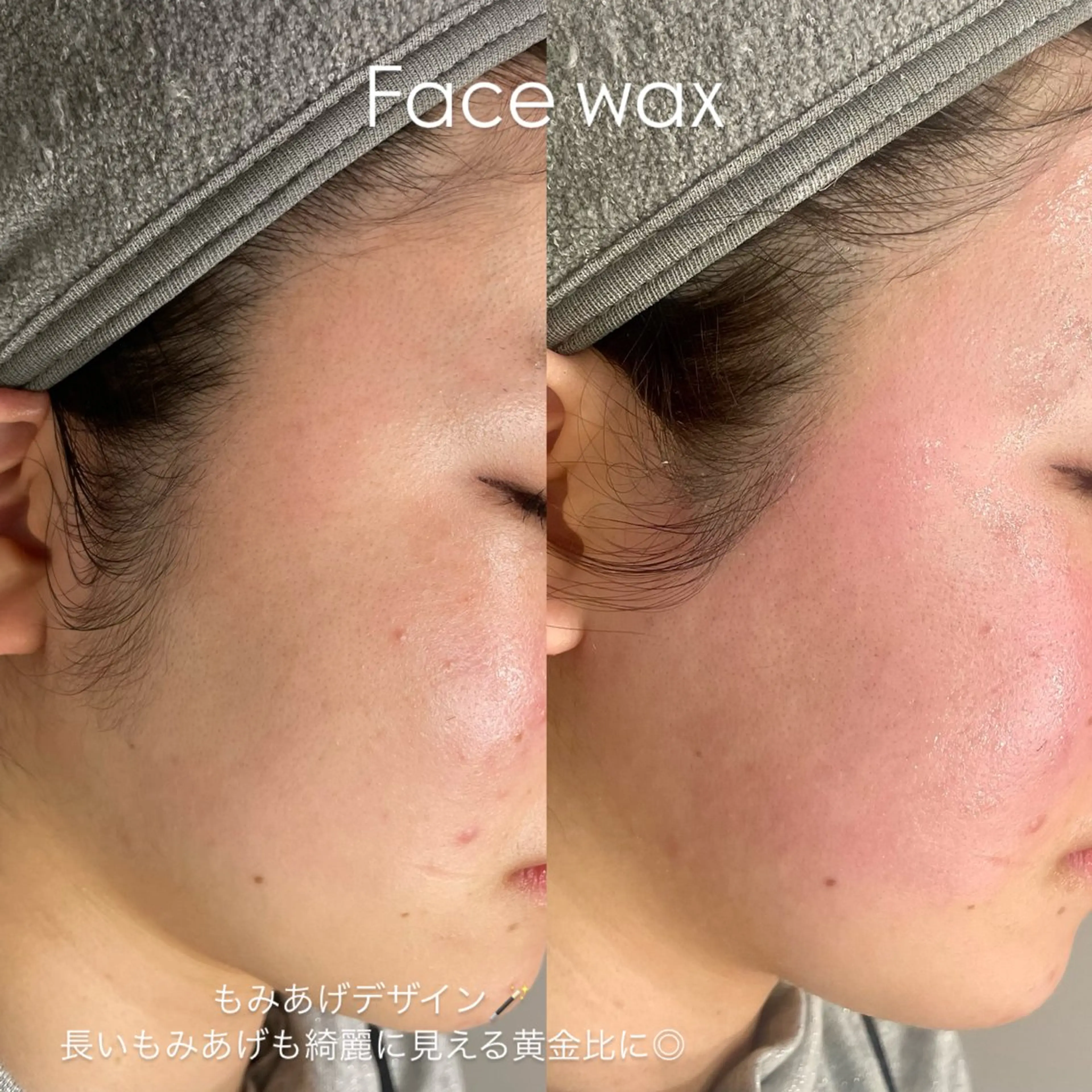 脱毛 suu ｜harukaのマツエク・マツパデザイン