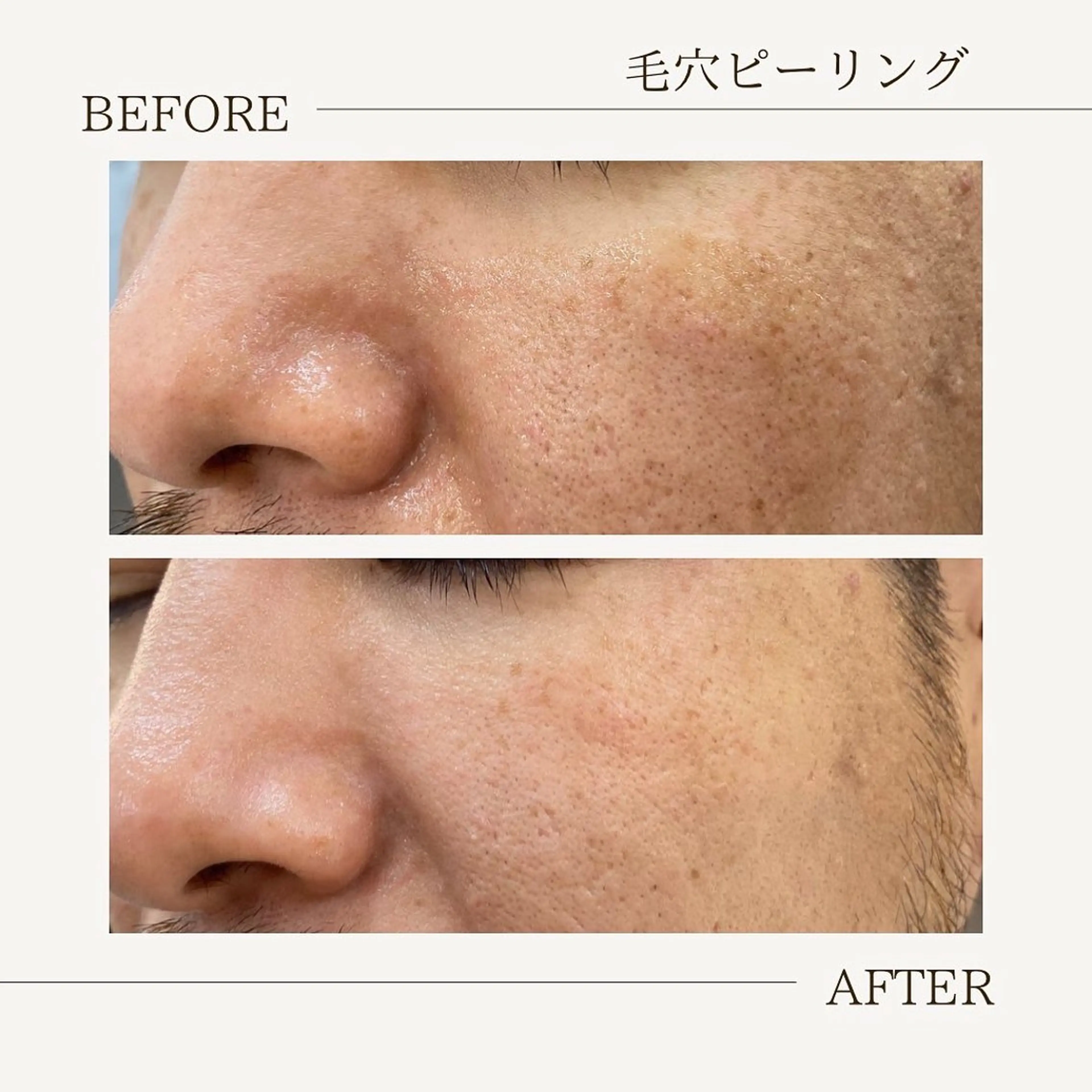 肌育成サロン ♡ RISAのエステ・リラクイメージ