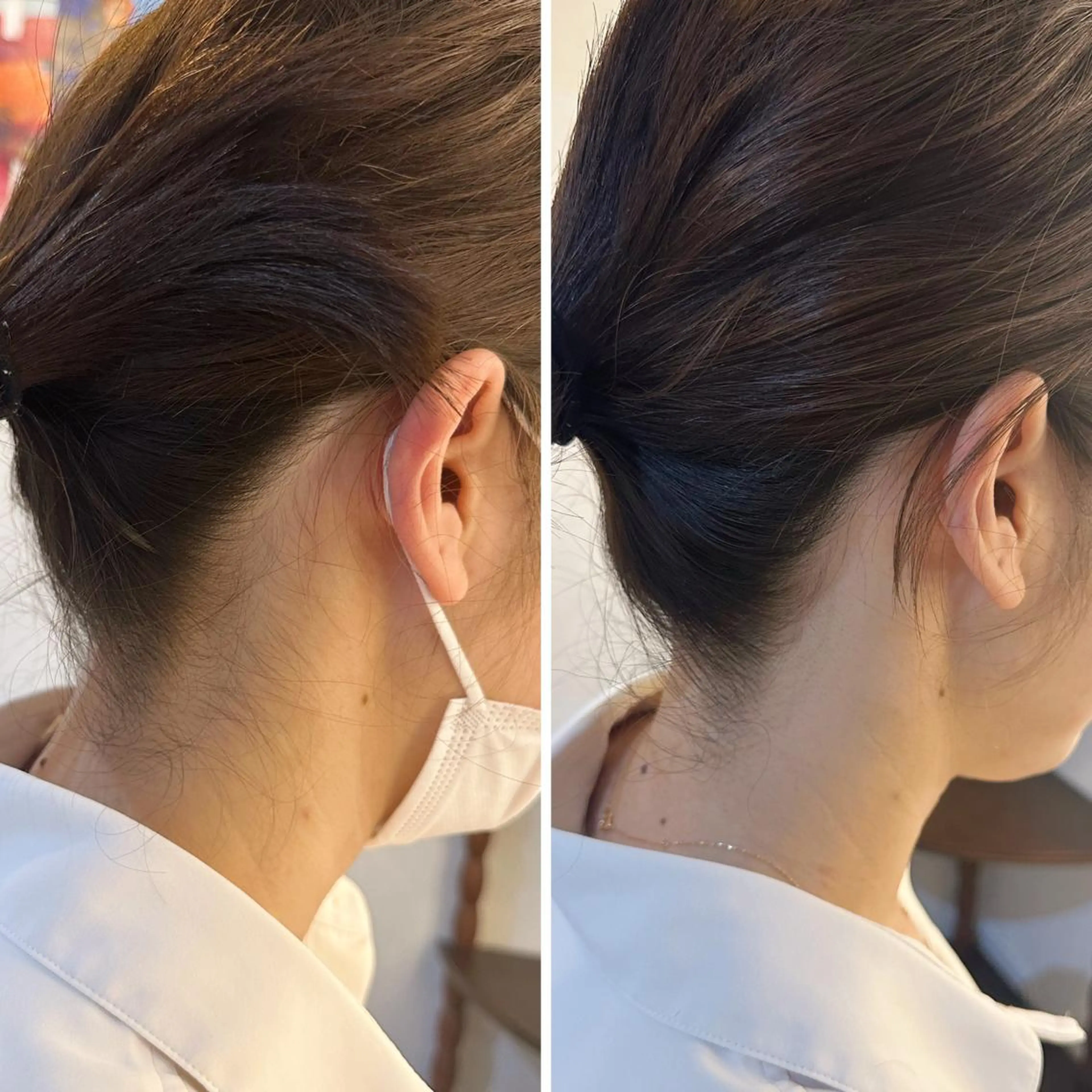 脱毛 うなじ脱毛/美肌脱毛 LABELのエステ・リラクイメージ