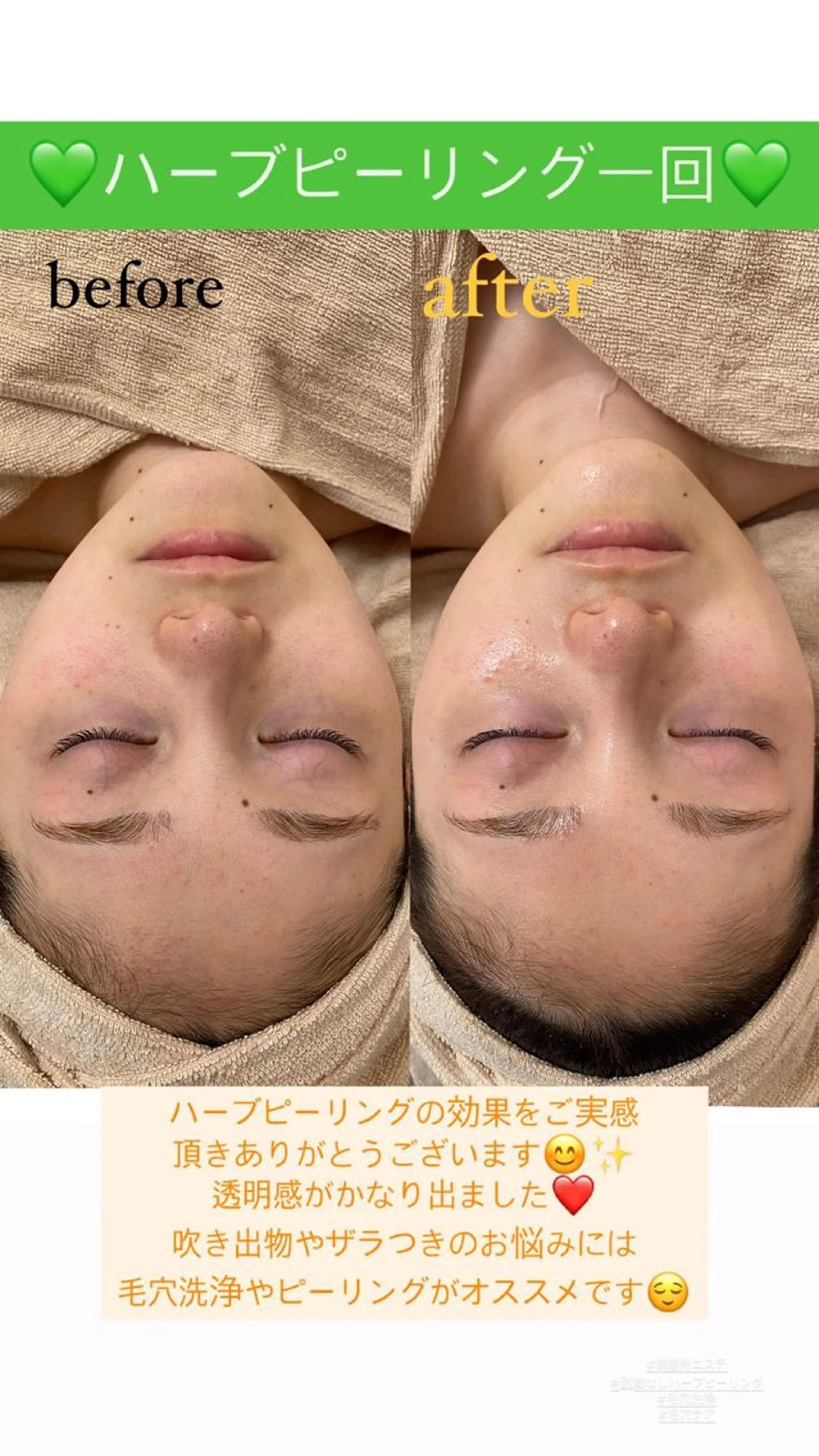 メンズ エステ Salon de Lino 御器所のエステ・リラクイメージ