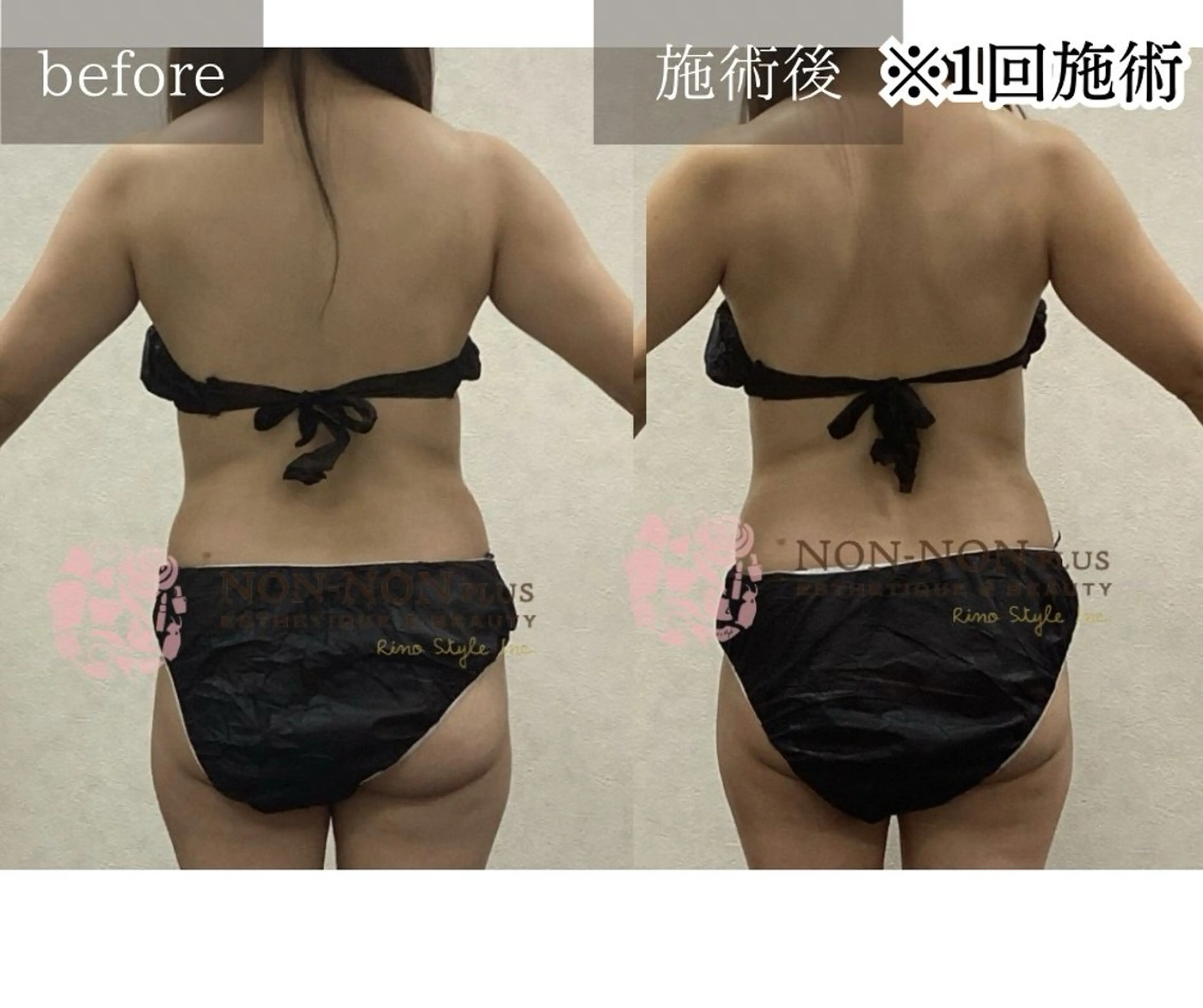 NON-NONプラス 大人の本気痩身のエステ・リラクイメージ