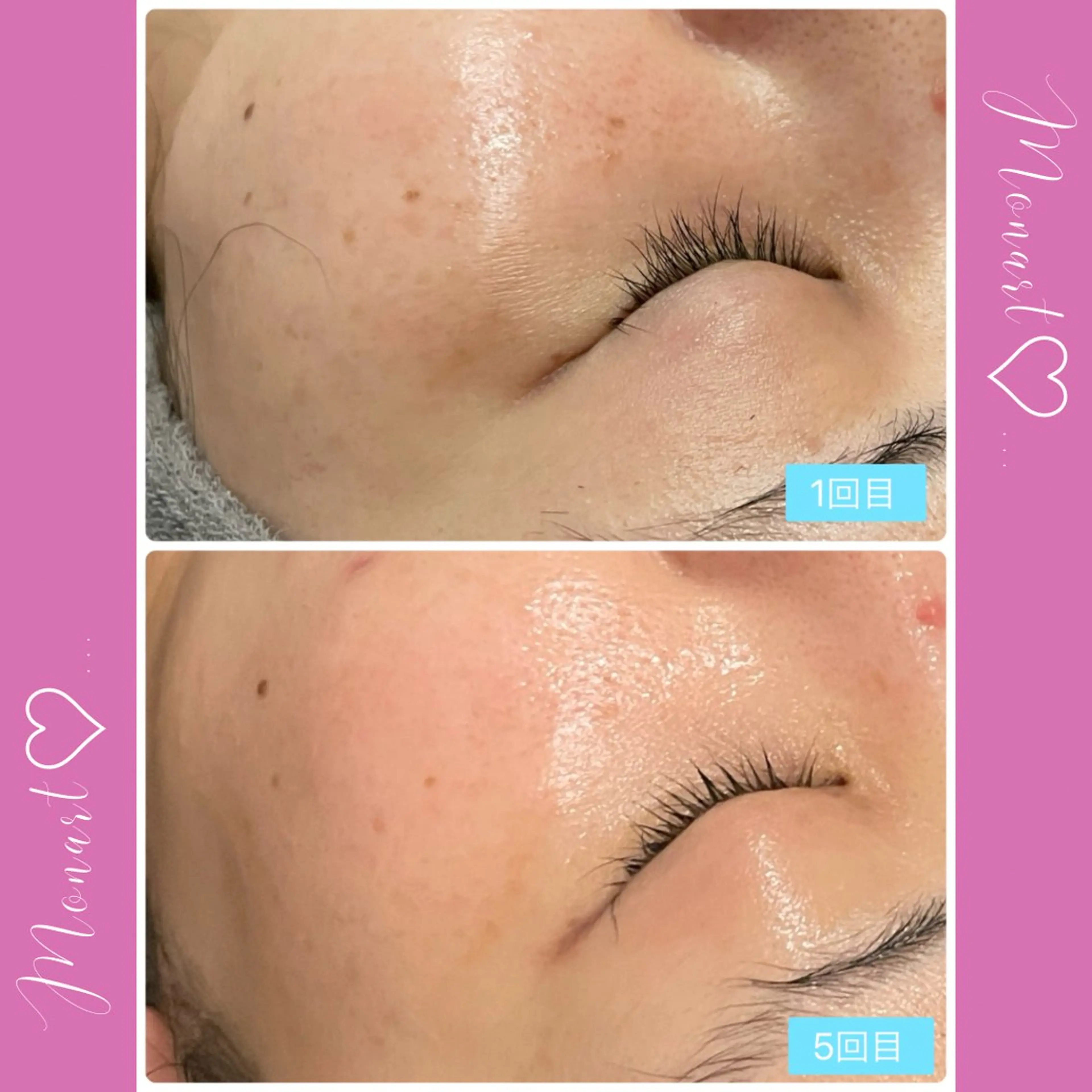 Monart -deux-のエステ・リラクイメージ