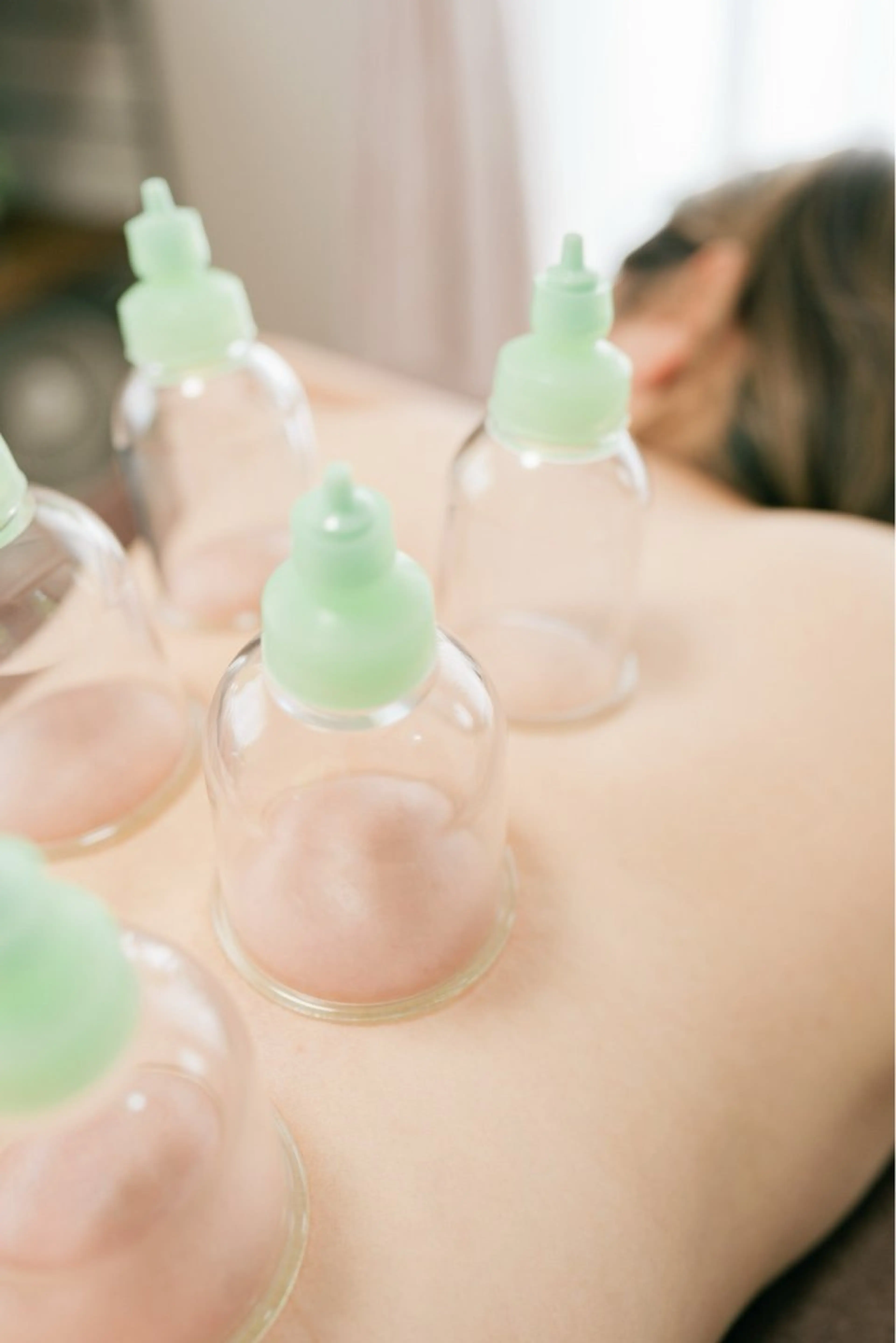 めぐりを整える 温活カッピングの写真