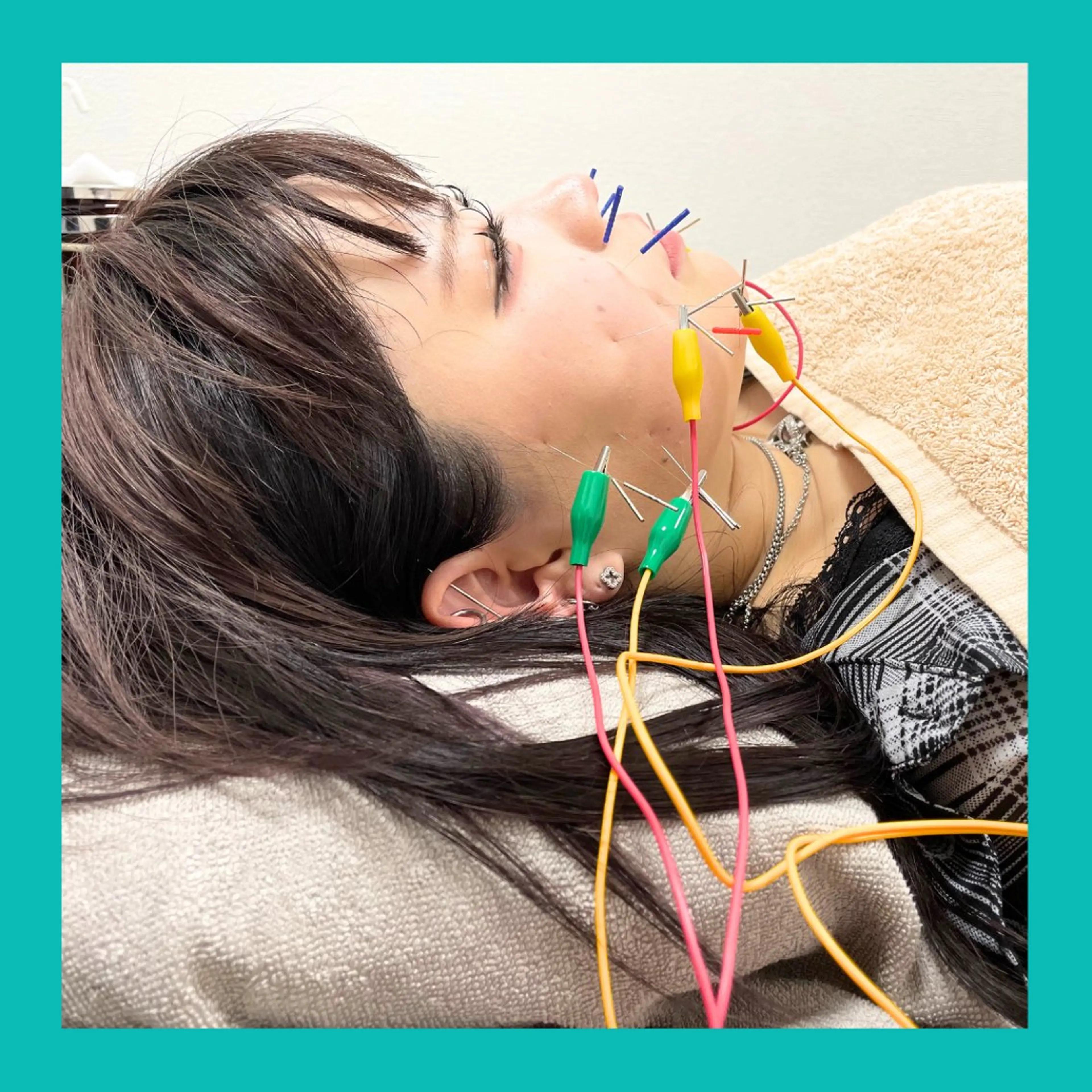 キャンディ鍼灸整骨院 きくたのその他イメージ