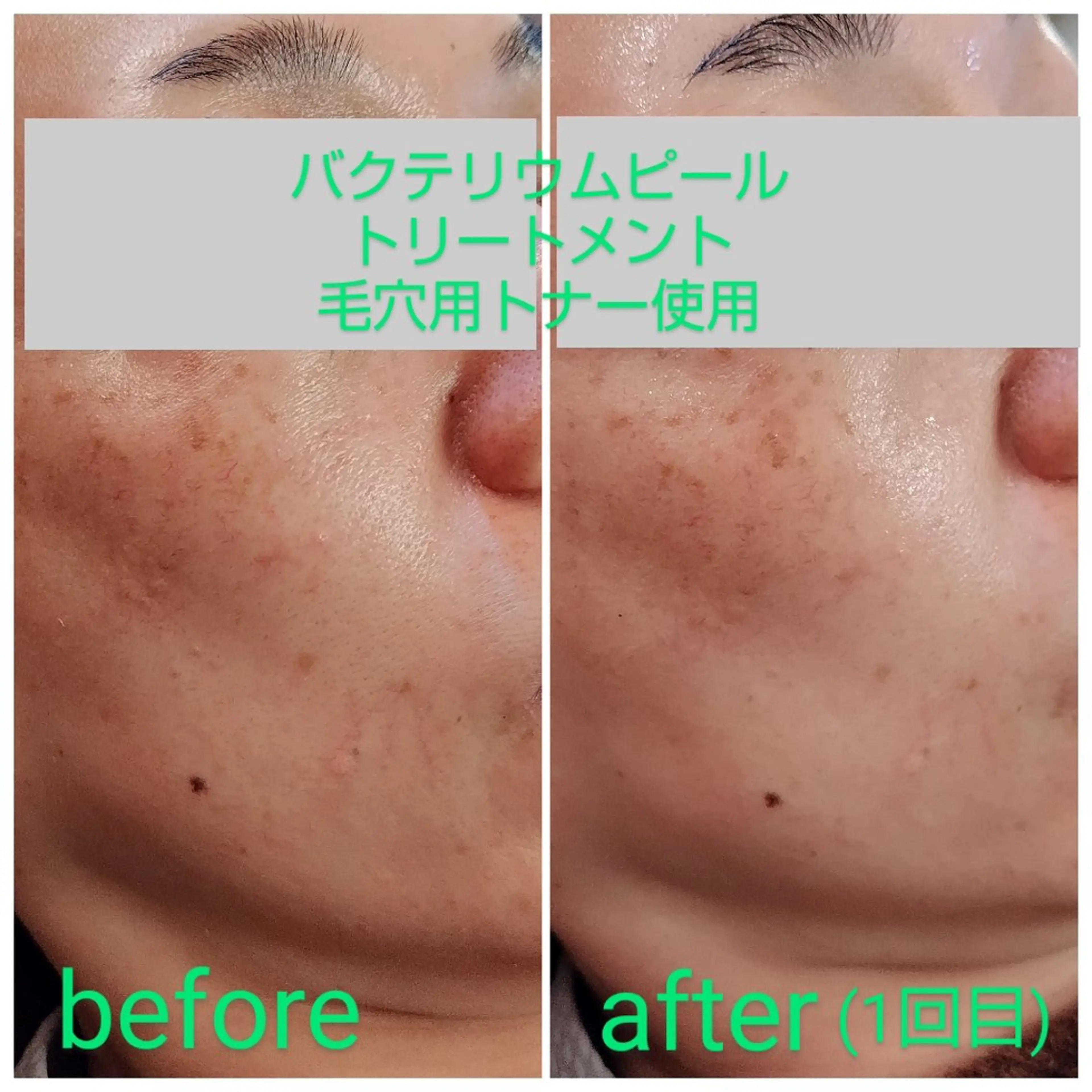 エステ Lottie所属・Lottie リラク担当Asukaのエステ・リラクイメージ