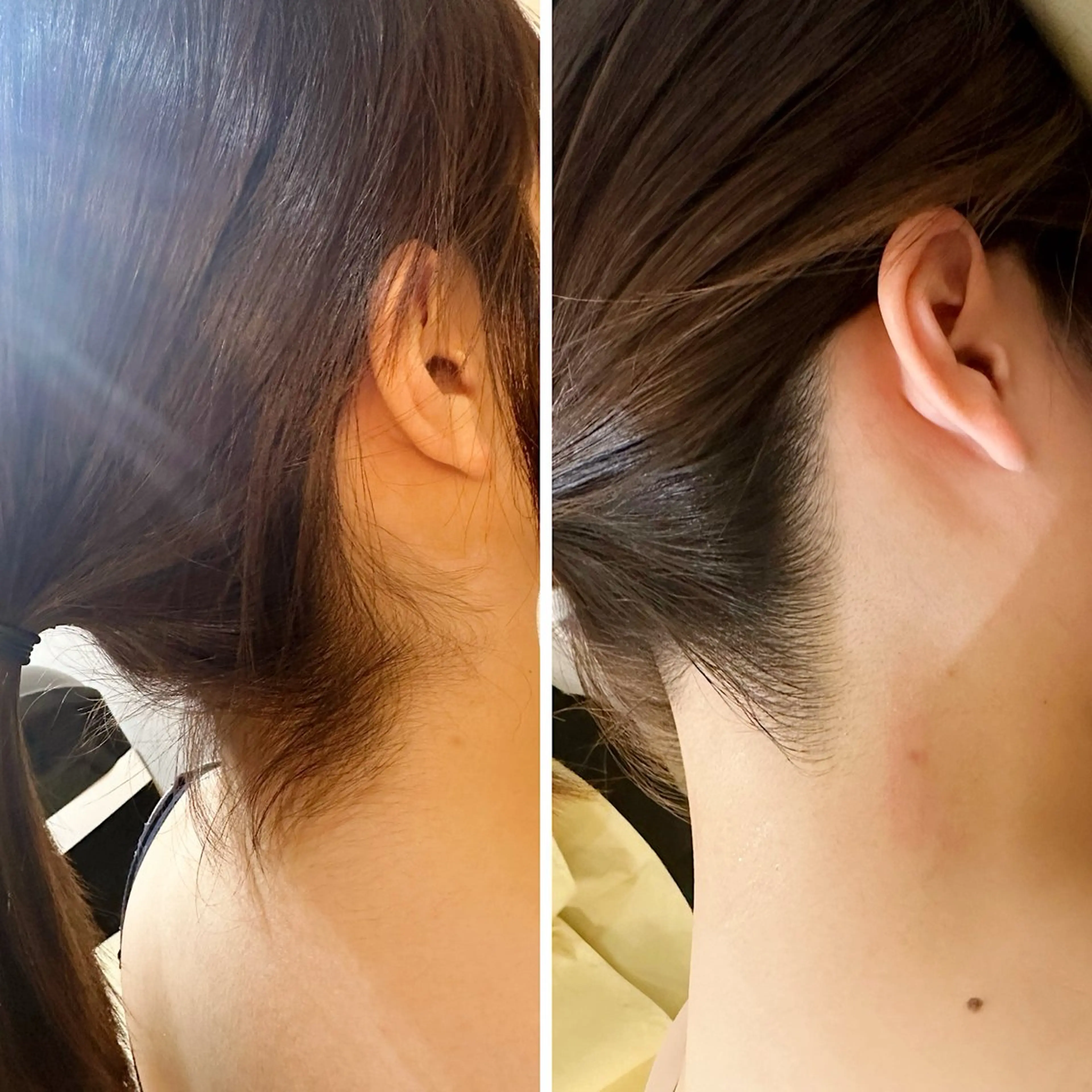 脱毛 うなじ脱毛/美肌脱毛 LABELのエステ・リラクイメージ