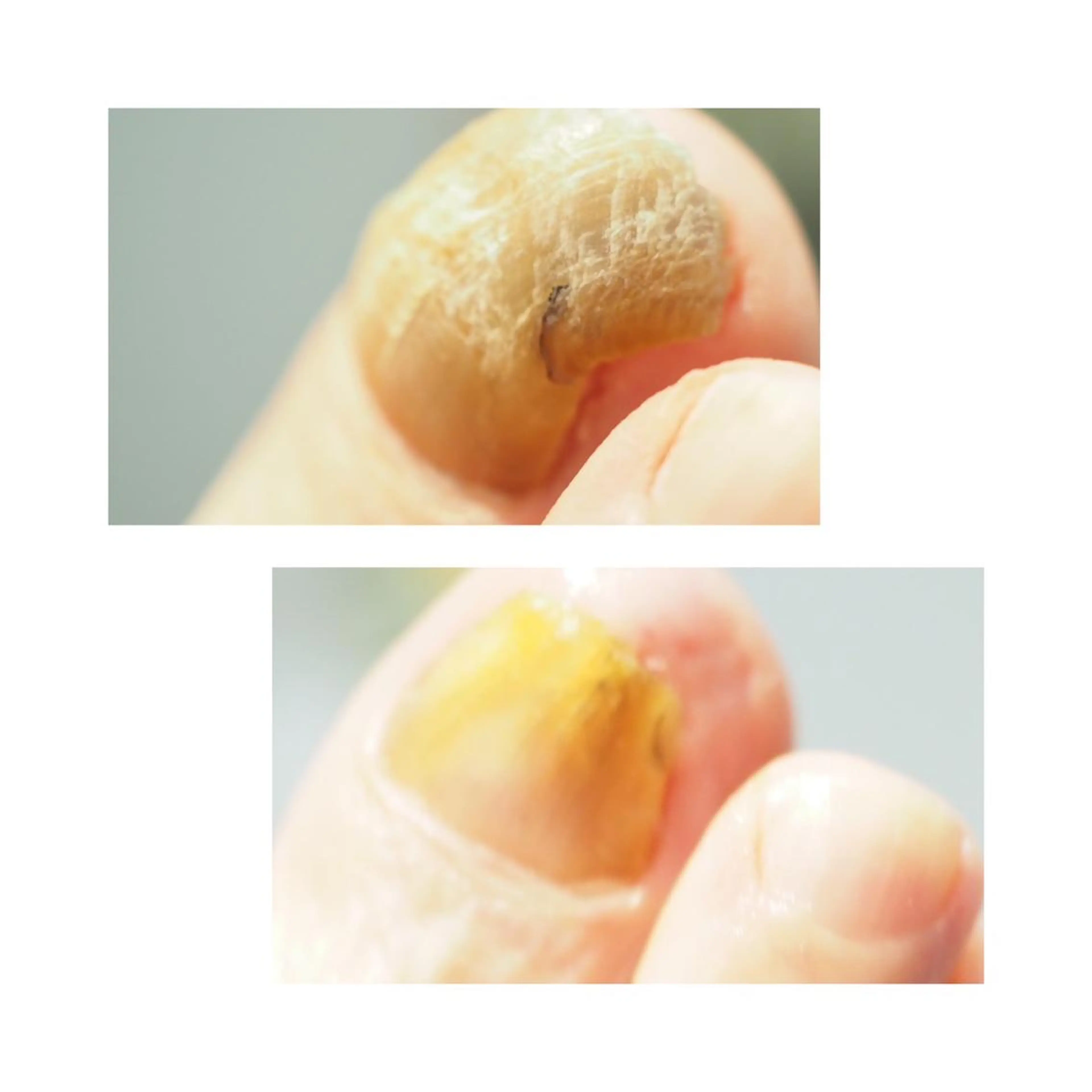 LIZERA&CO(charitesfam内)所属・南古谷 松本 かよのネイルデザイン